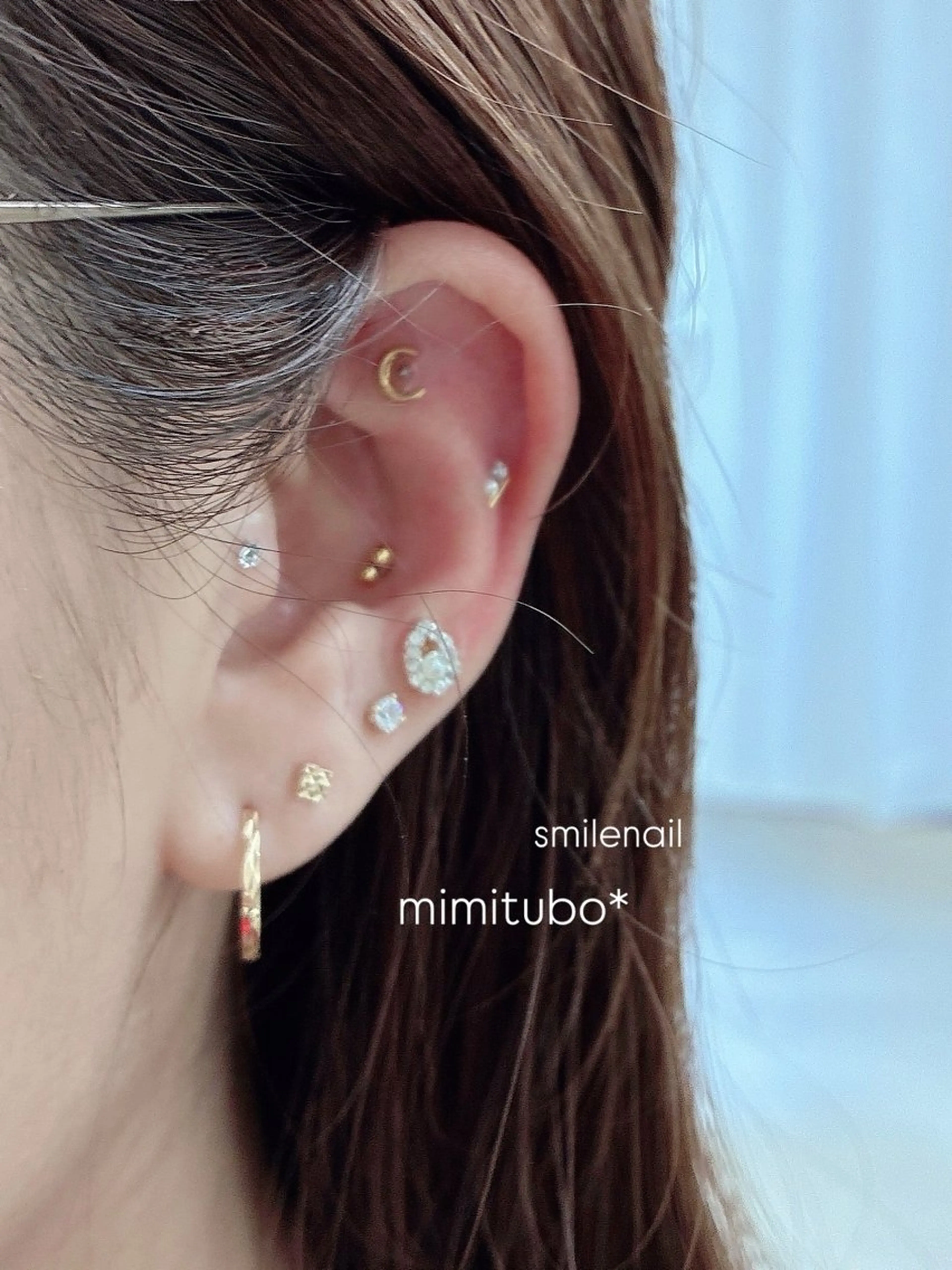 その他 smileskin 京都/meguのその他イメージ