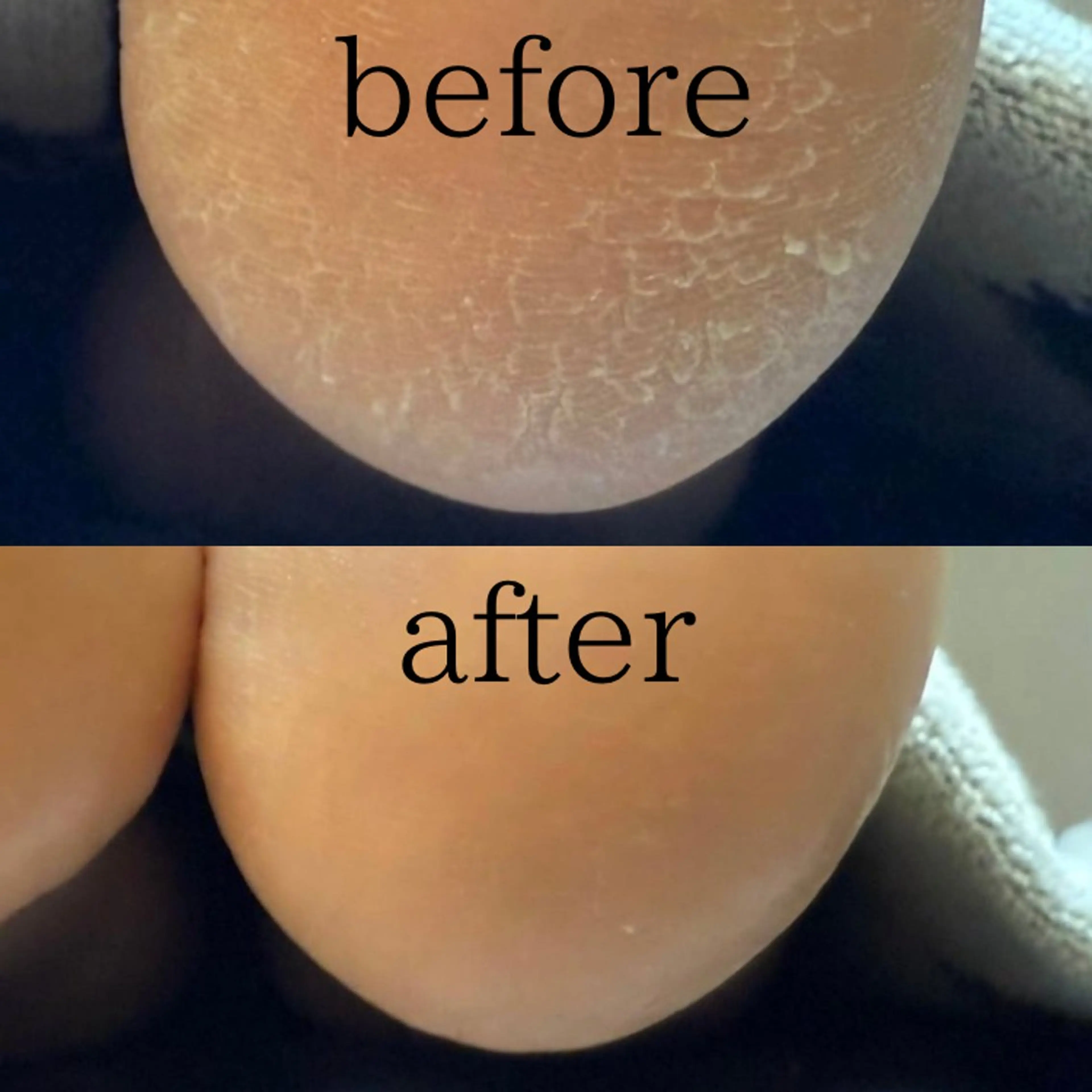 メンズ メンズ韓国風 脱毛サロン Terry所属・脱毛サロン Terryのエステ・リラクイメージ