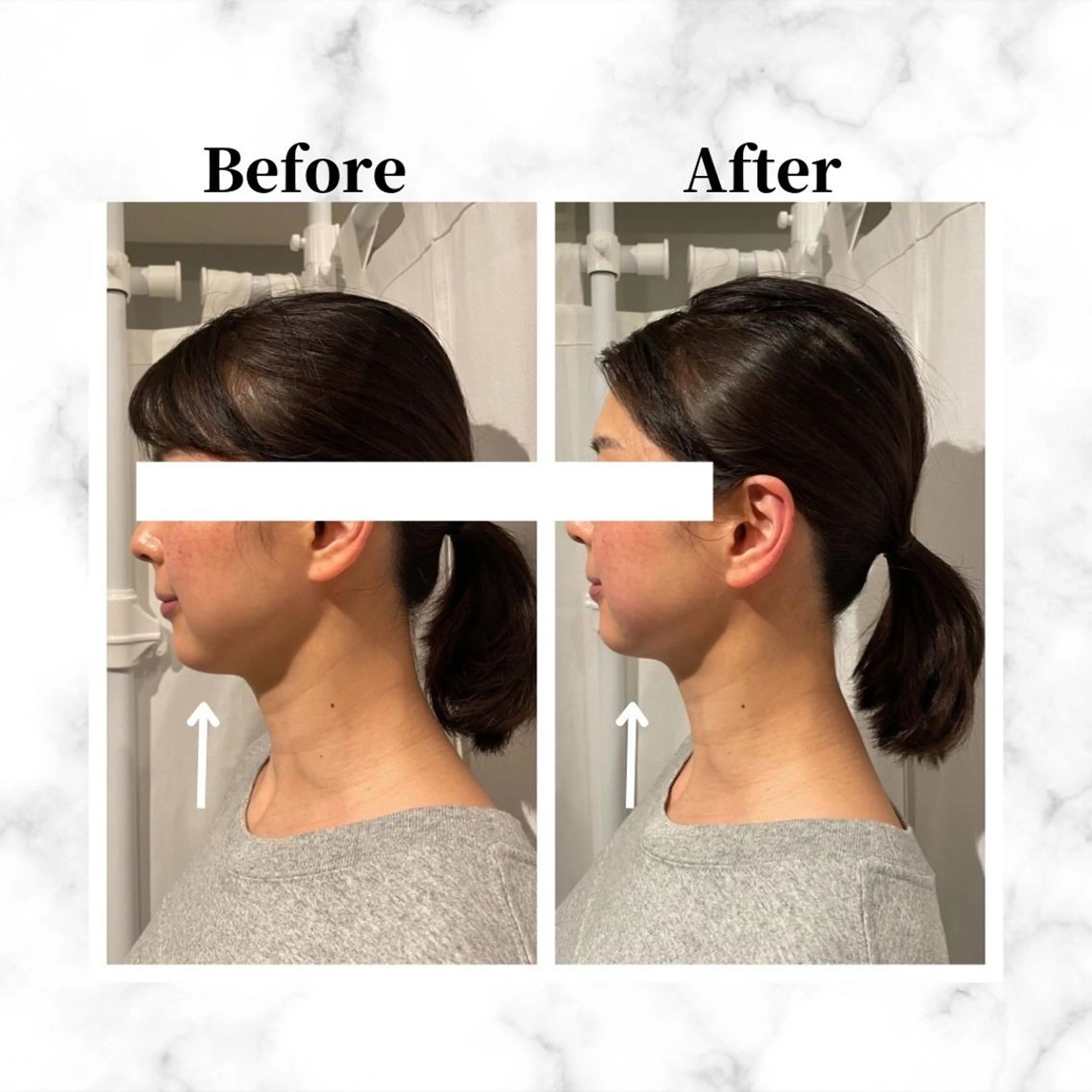 エステ リラク 12Dハイフ💗 最強小顔のエステ・リラクイメージ