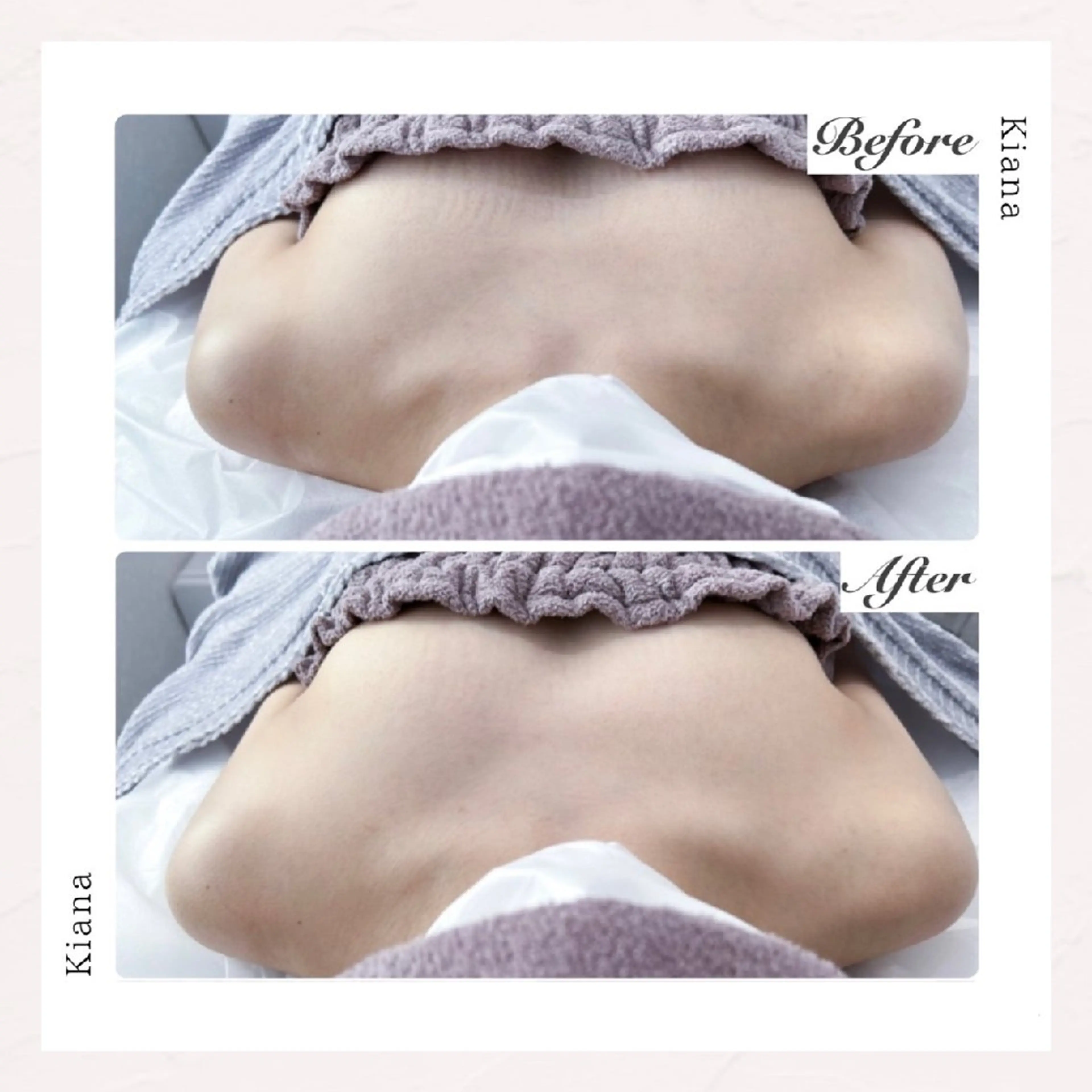 【バスト専門店 】 Kiana のエステ・リラクイメージ