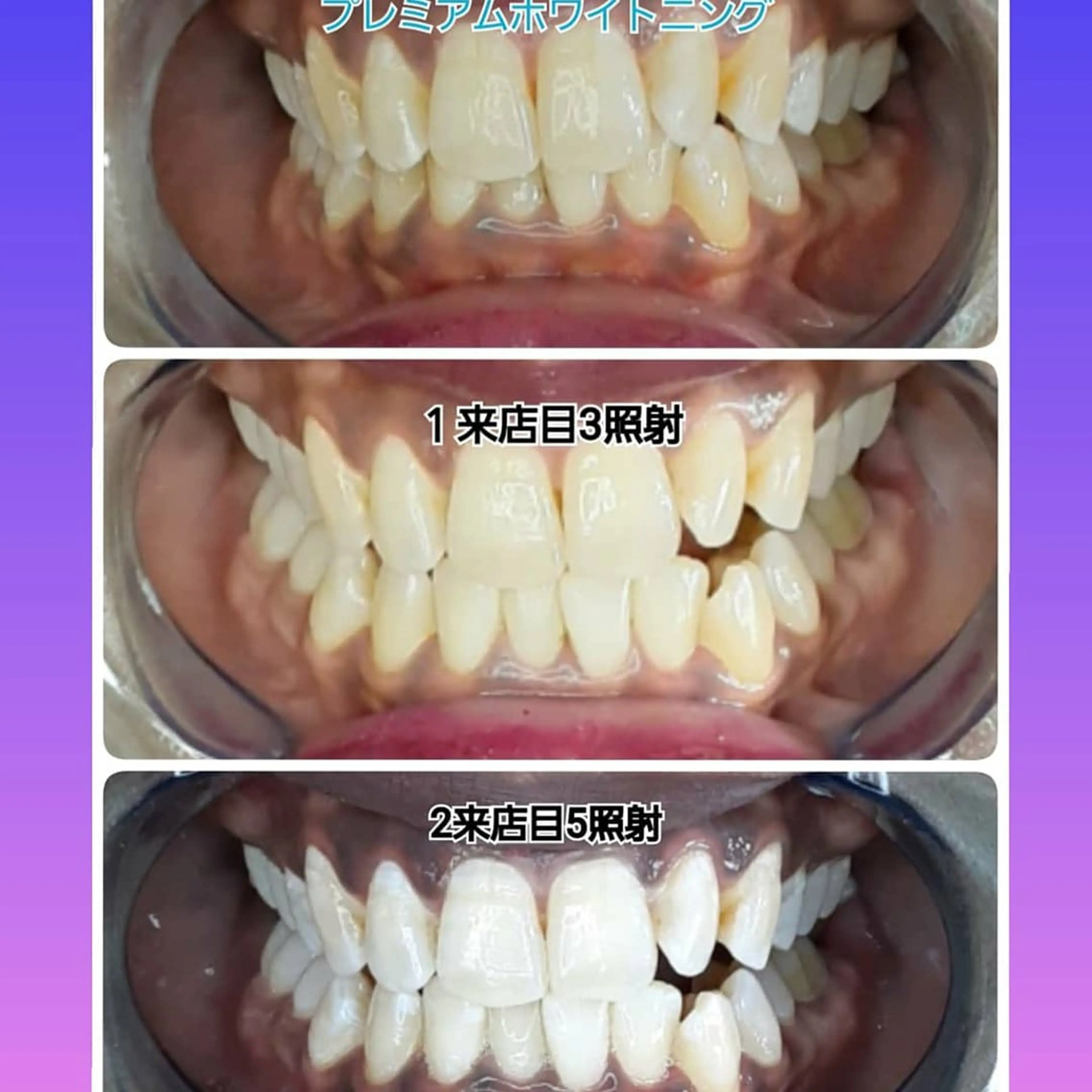 その他 五十嵐 蓮のその他イメージ