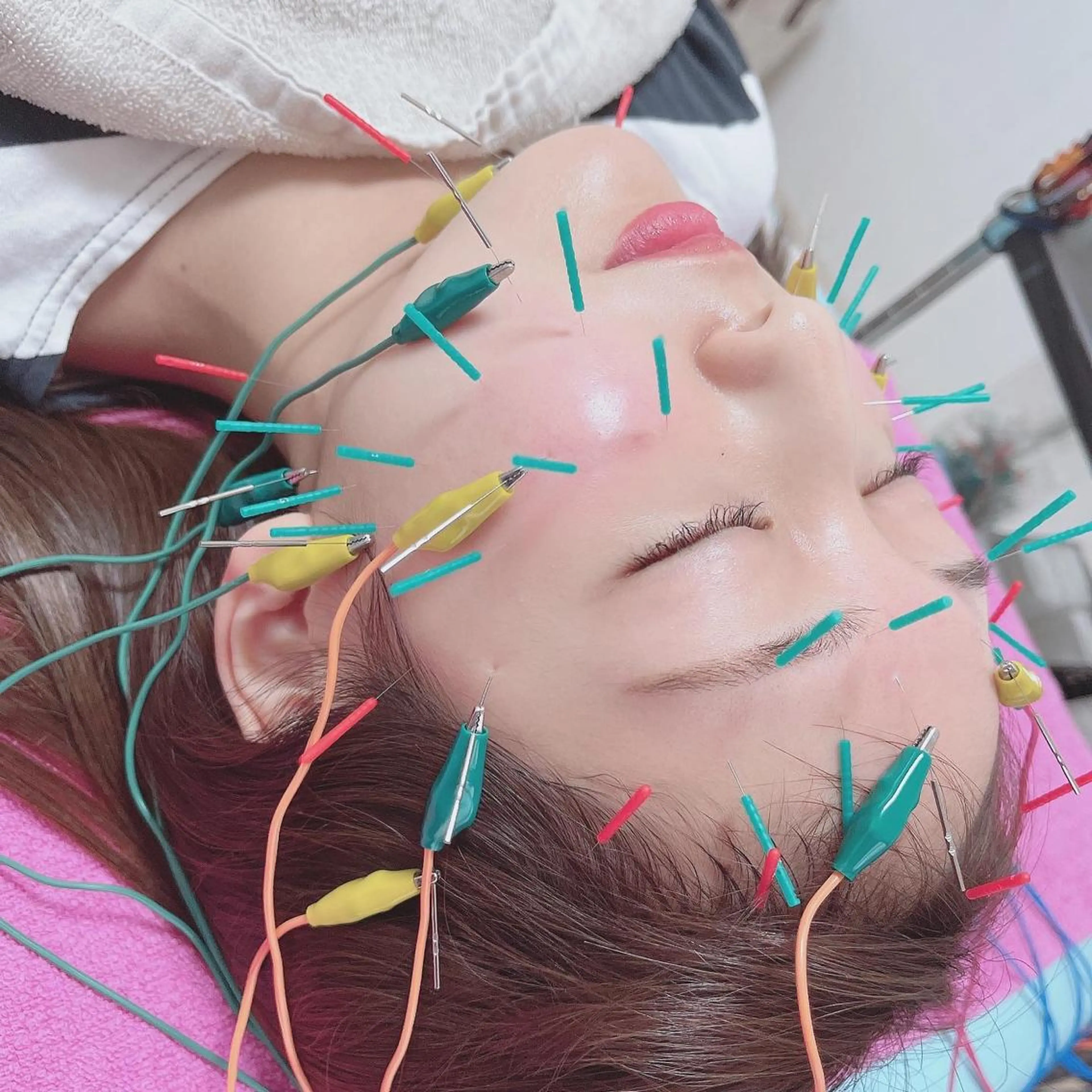 《新規様限定》小顔/食いしばり/歪み が気になる方へ✨️スタイリングコース 小顔ver. 100分 ✨️の写真