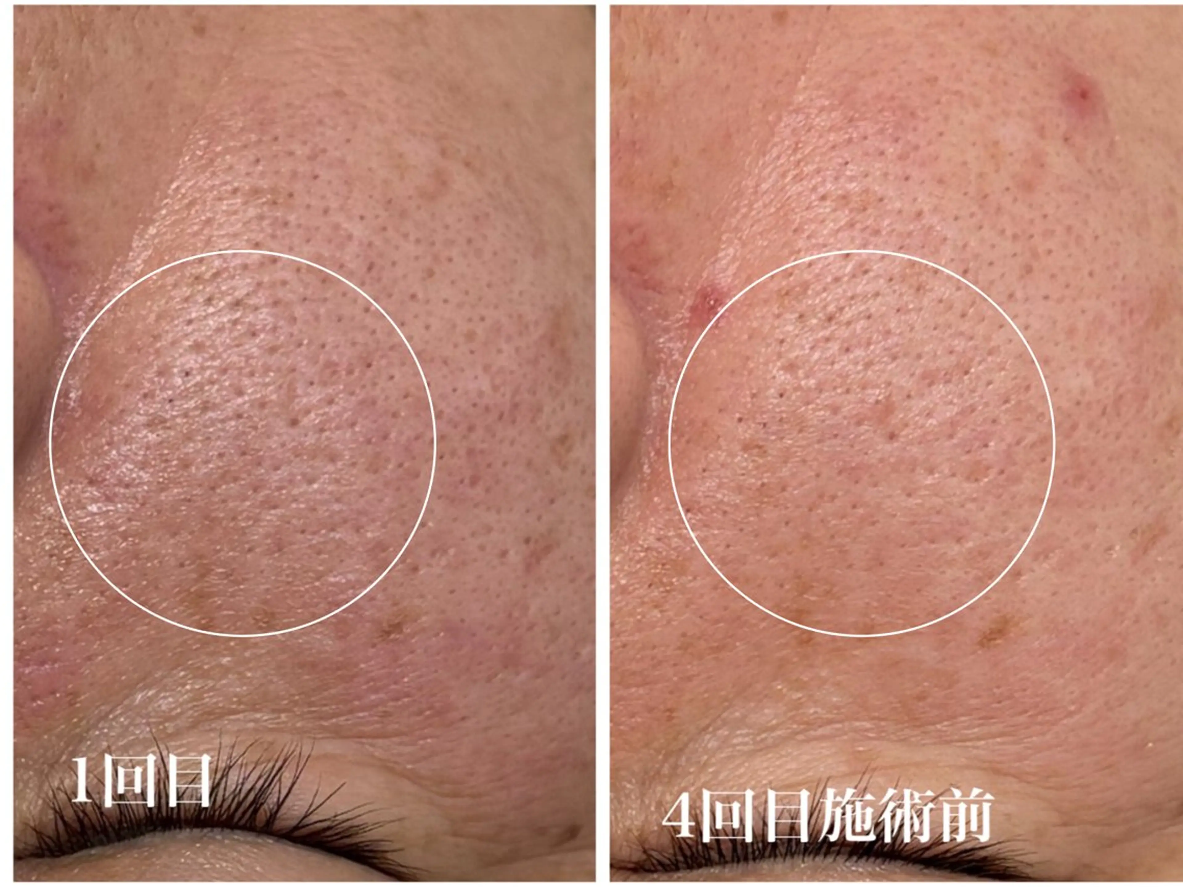 フェイシャルサロンKey of Face所属・村上 貴子のエステ・リラクイメージ