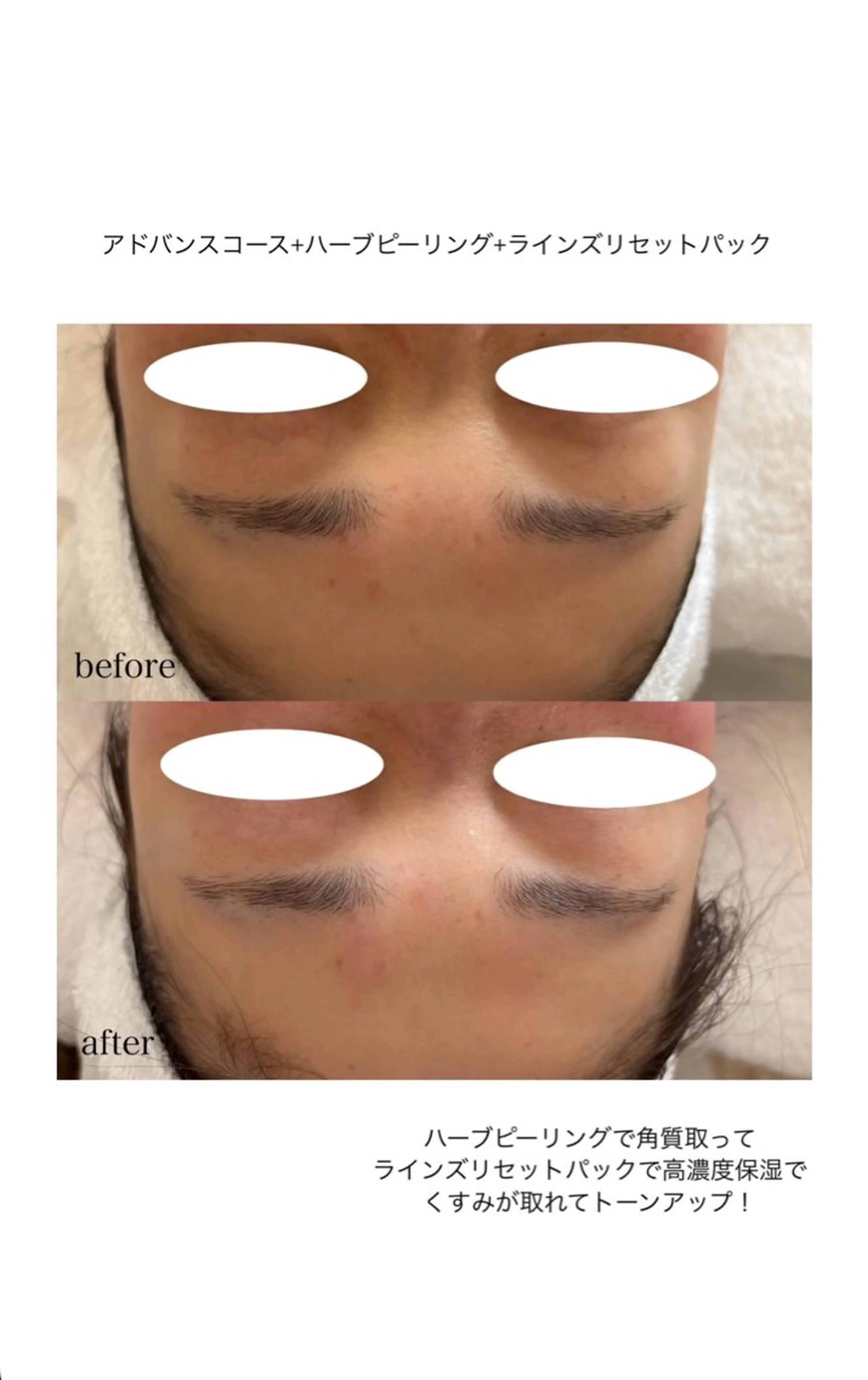 メナードフェイシャルサロン 熊本インター西店所属・フェイシャルエステ 🎀　naoのエステ・リラクイメージ