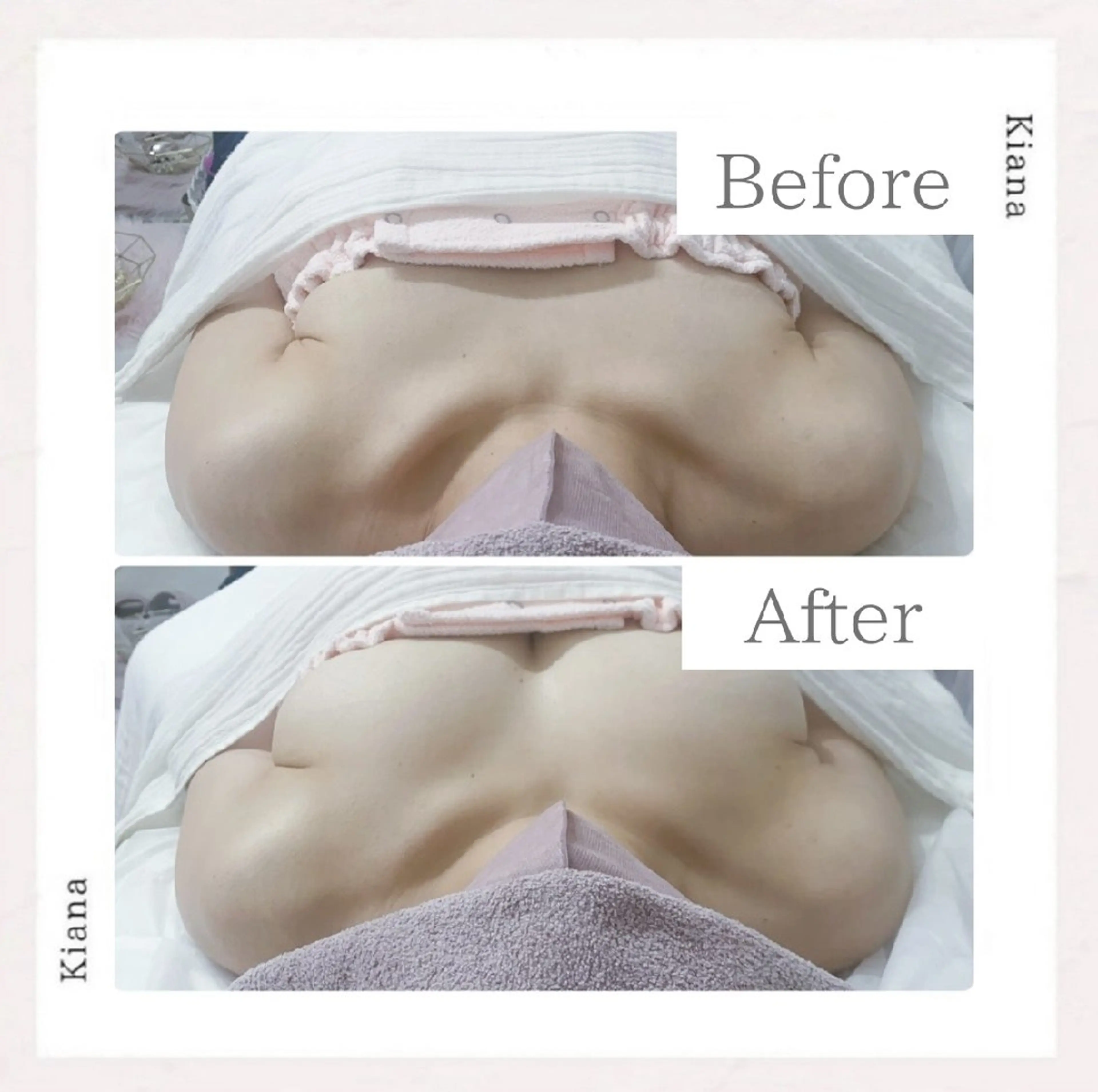 エステ リラク 【バスト専門店 】 Kiana のエステ・リラクイメージ