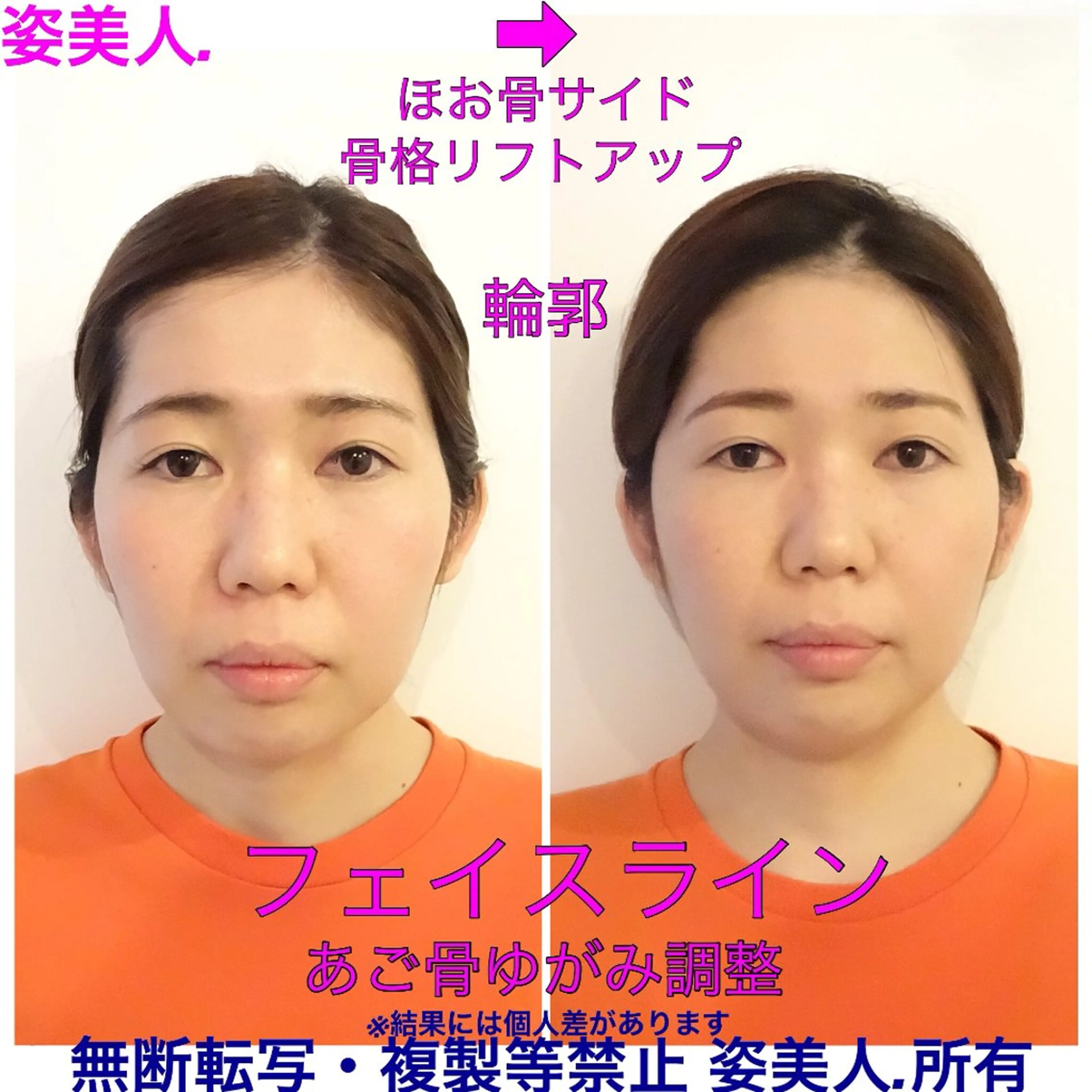 筋膜整体＆小顔矯正 　姿美人.シルエットのエステ・リラクイメージ