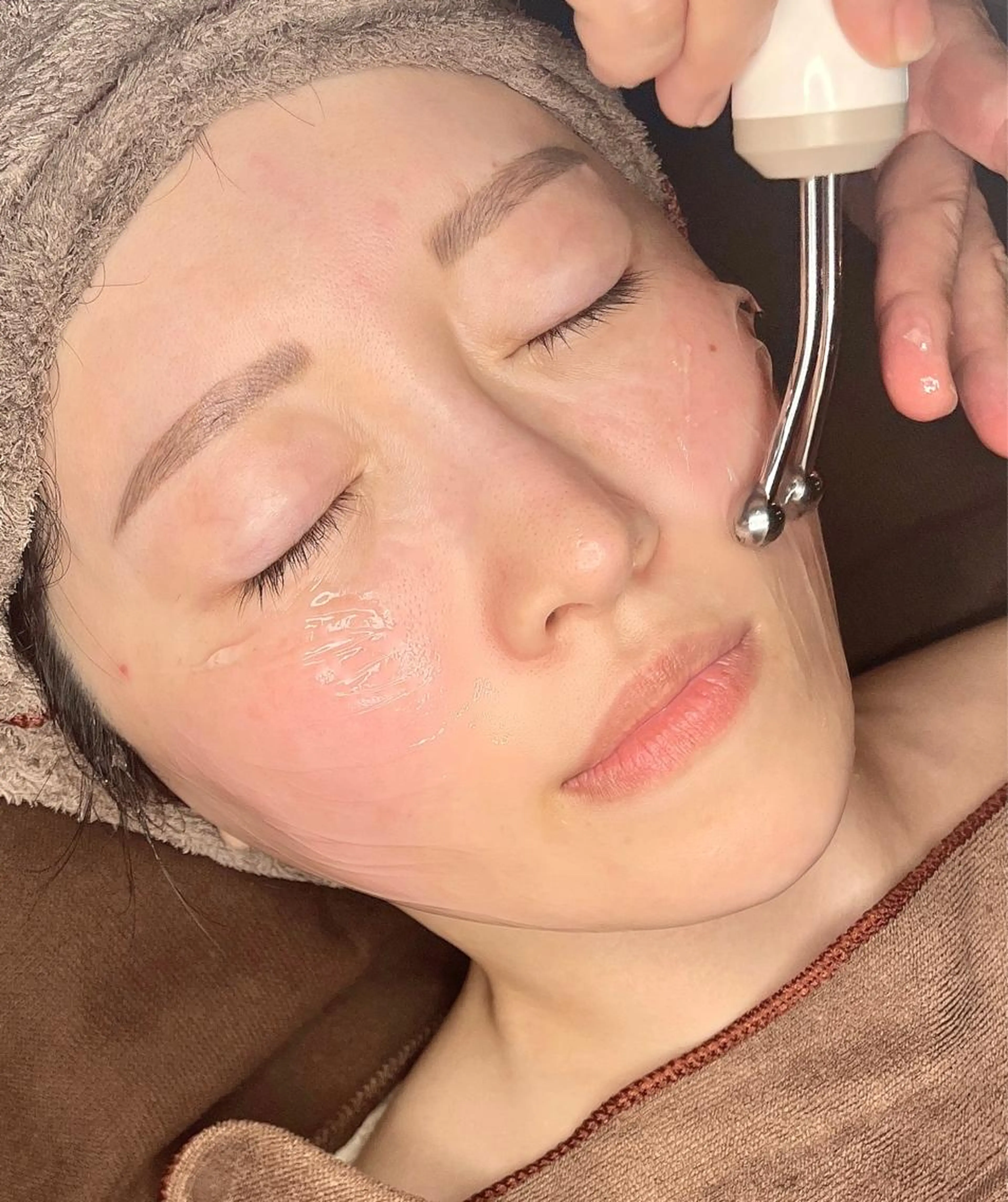 毛穴ごっそり，角質ケア「毛穴吸引hydroフェイシャル」の写真