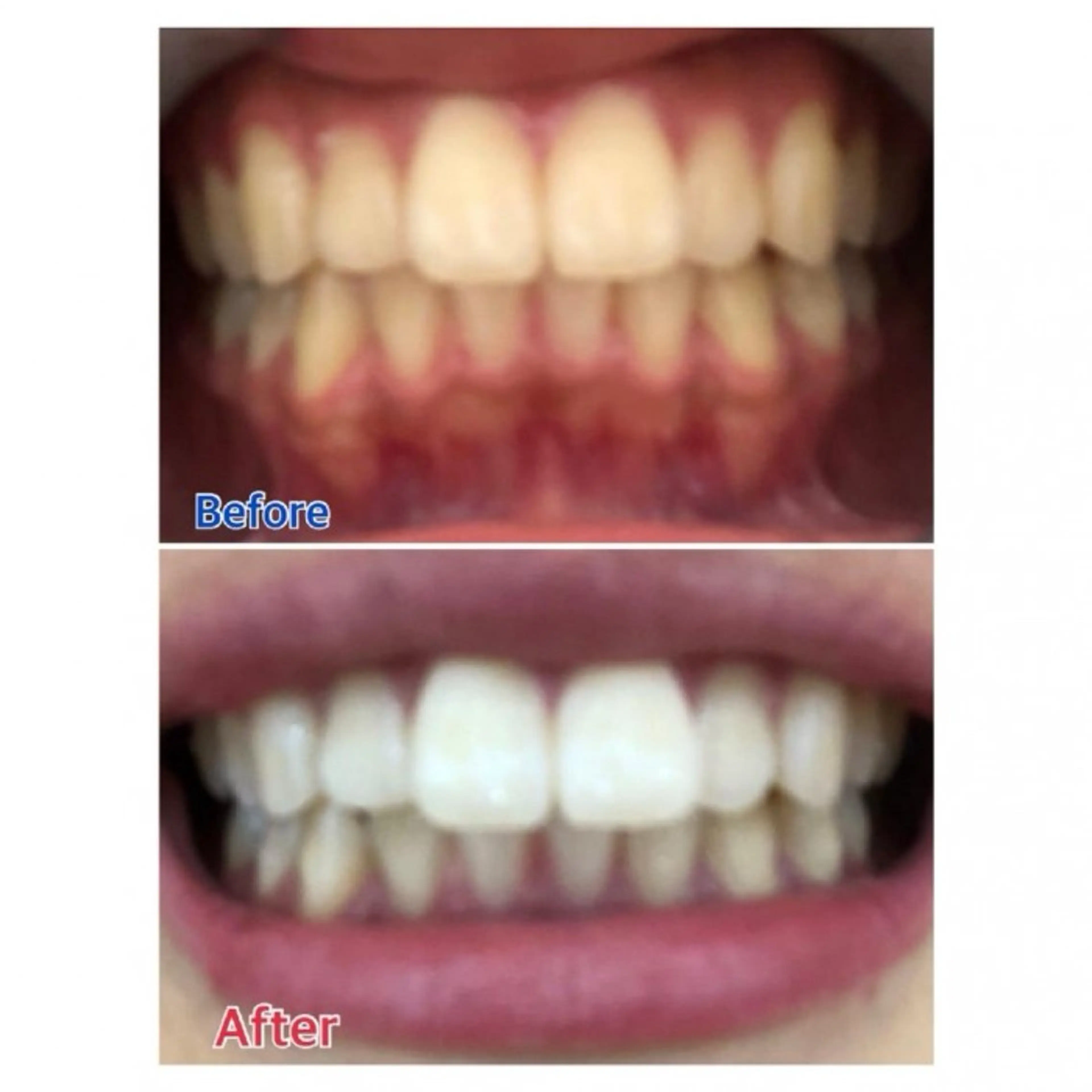 M渋谷店所属・Ｍ渋谷 ホワイトニングのその他イメージ