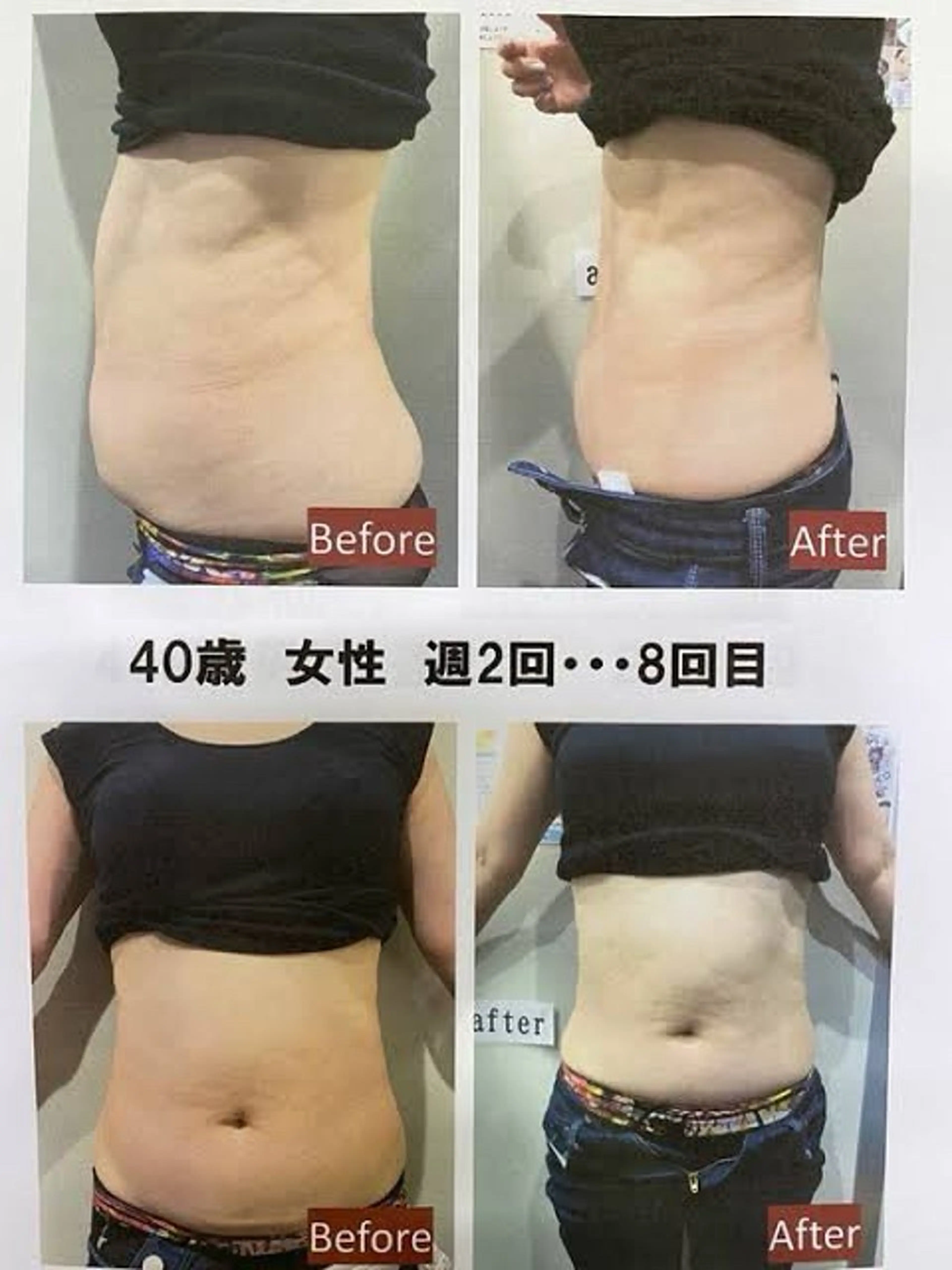 BeautySalonSoin所属・【医療提携エステ】 痩身専門Soinのエステ・リラクイメージ