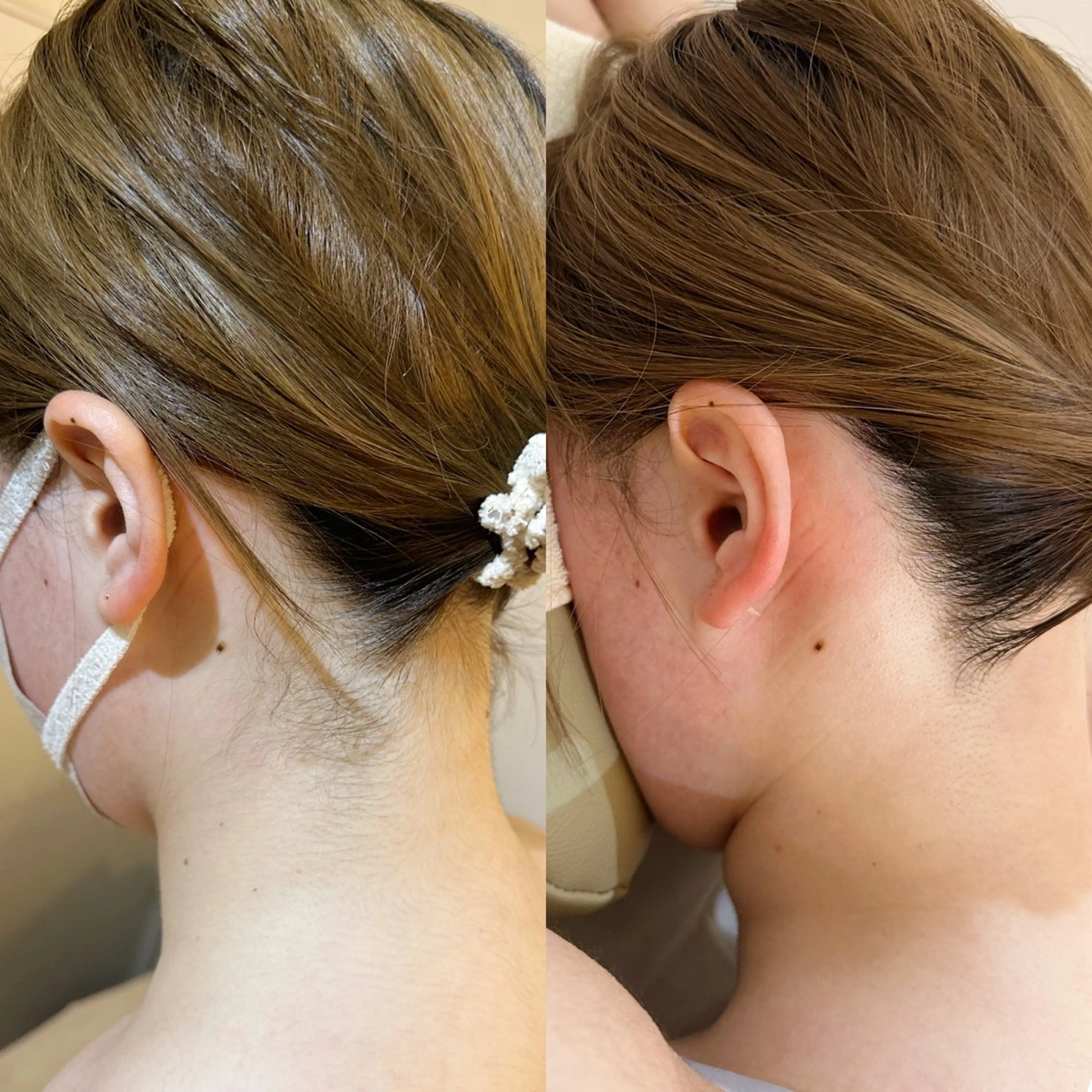 脱毛 うなじ脱毛/美肌脱毛 LABELのエステ・リラクイメージ