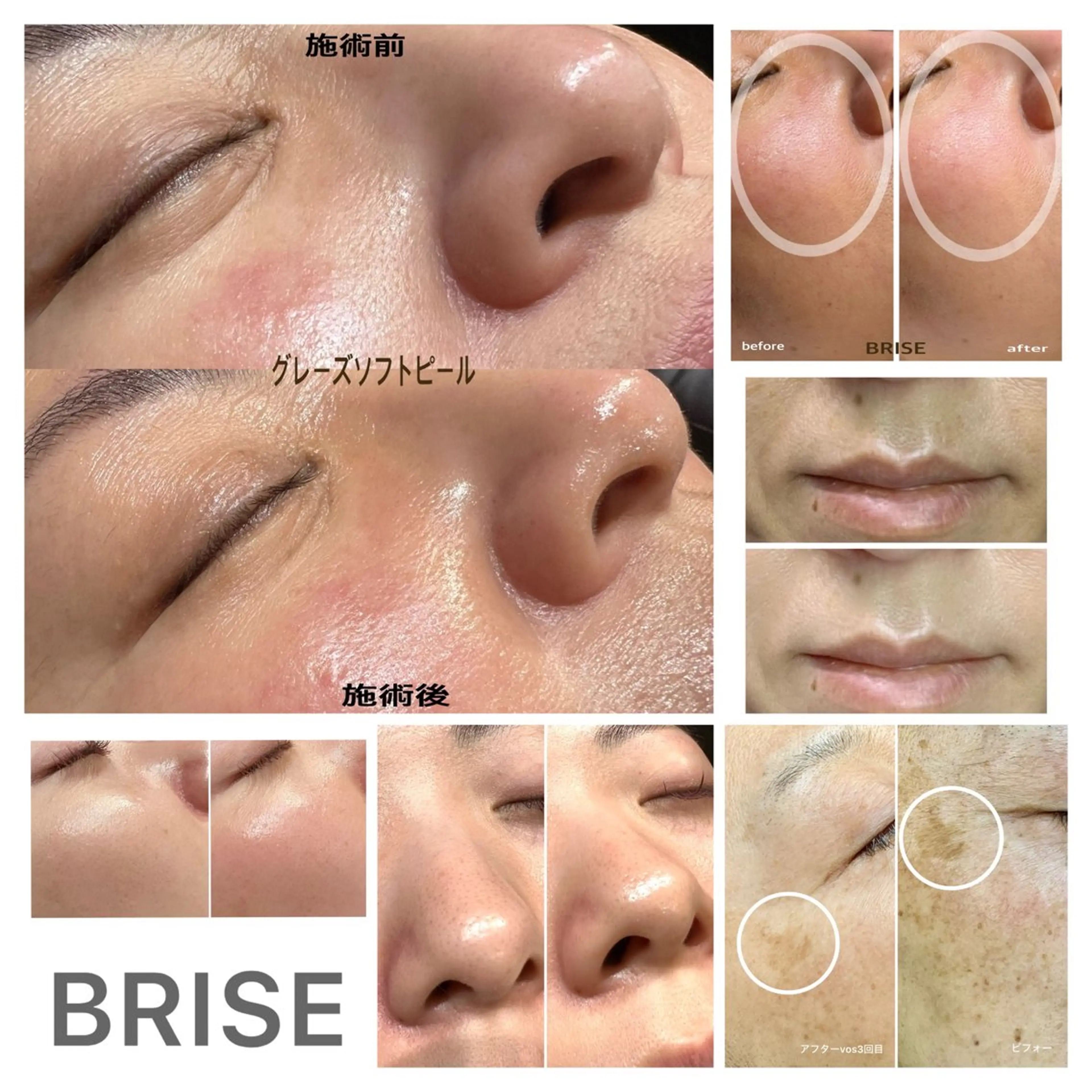 BRISE ブライズのエステ・リラクイメージ