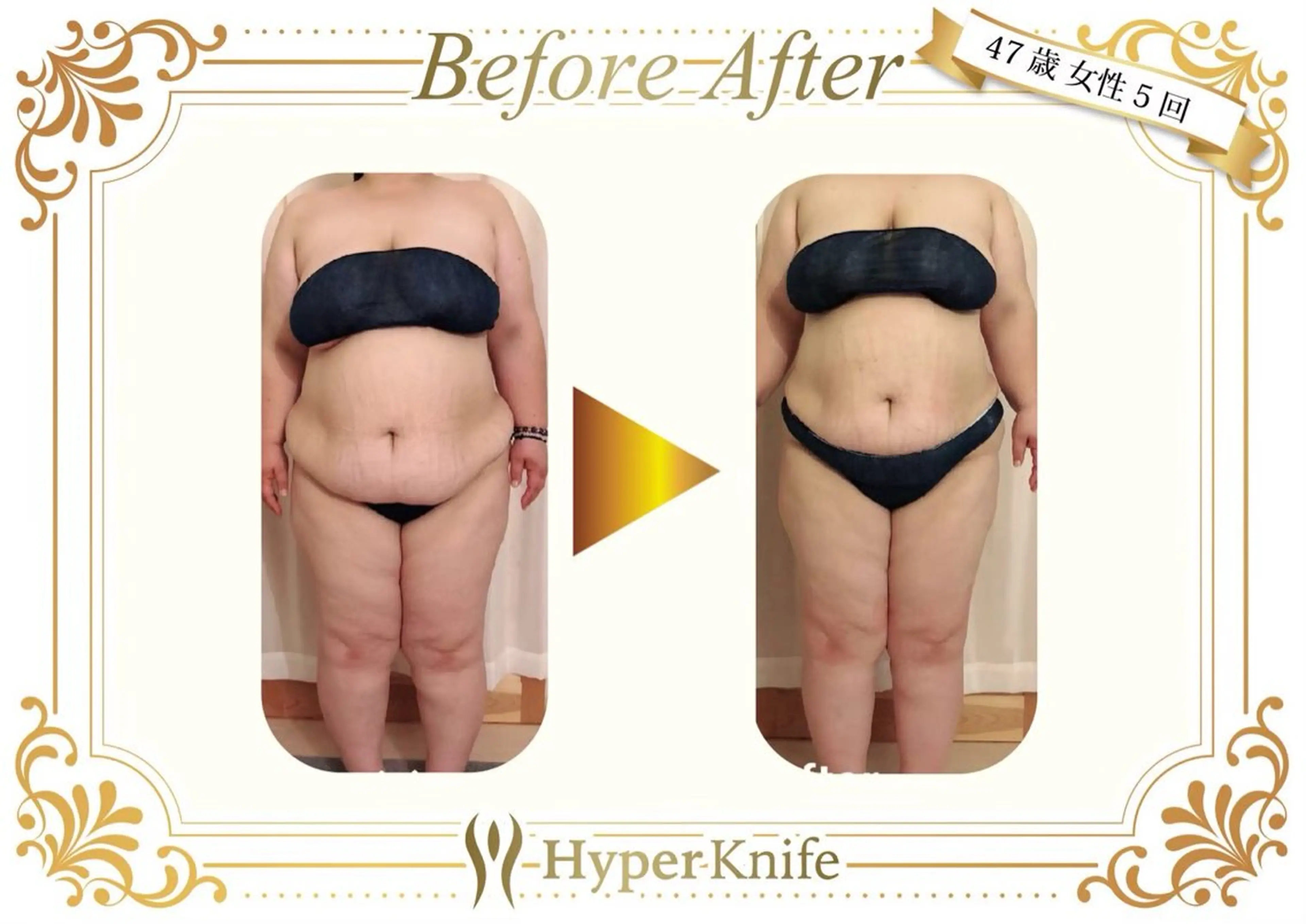 美癒 ハイパーナイフ&アロマ所属・美癒 池袋東口店のエステ・リラクイメージ