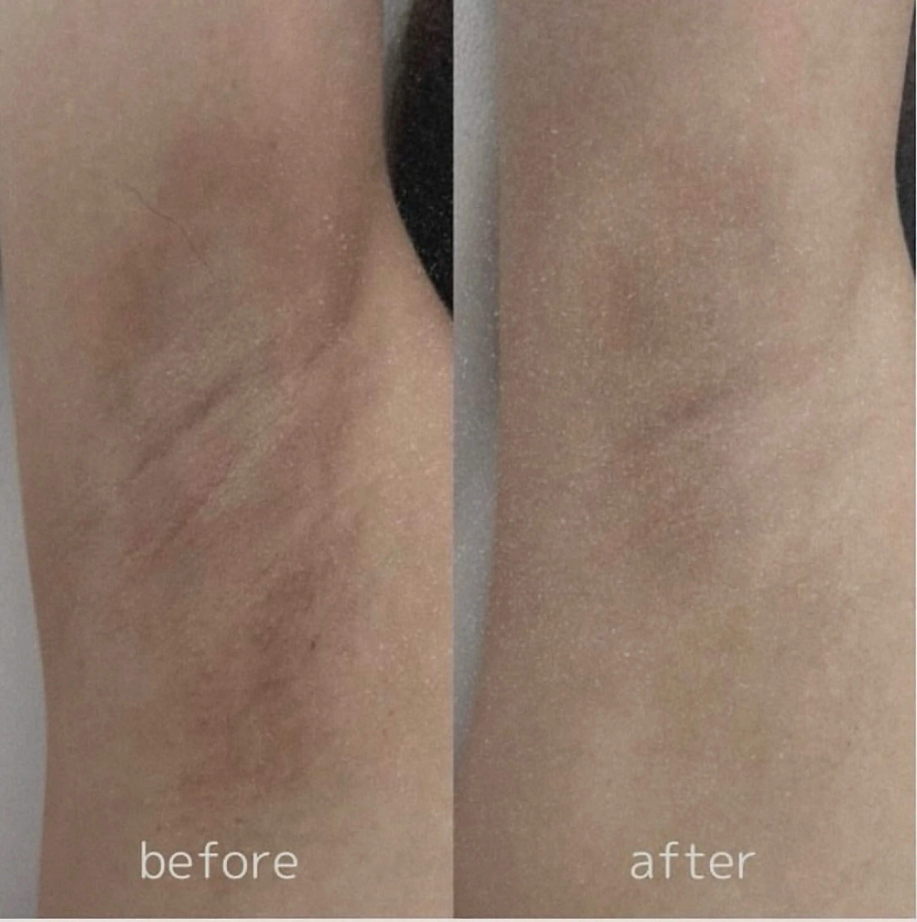 ROMA PINK 脇 モニター定価より40%OFFの写真