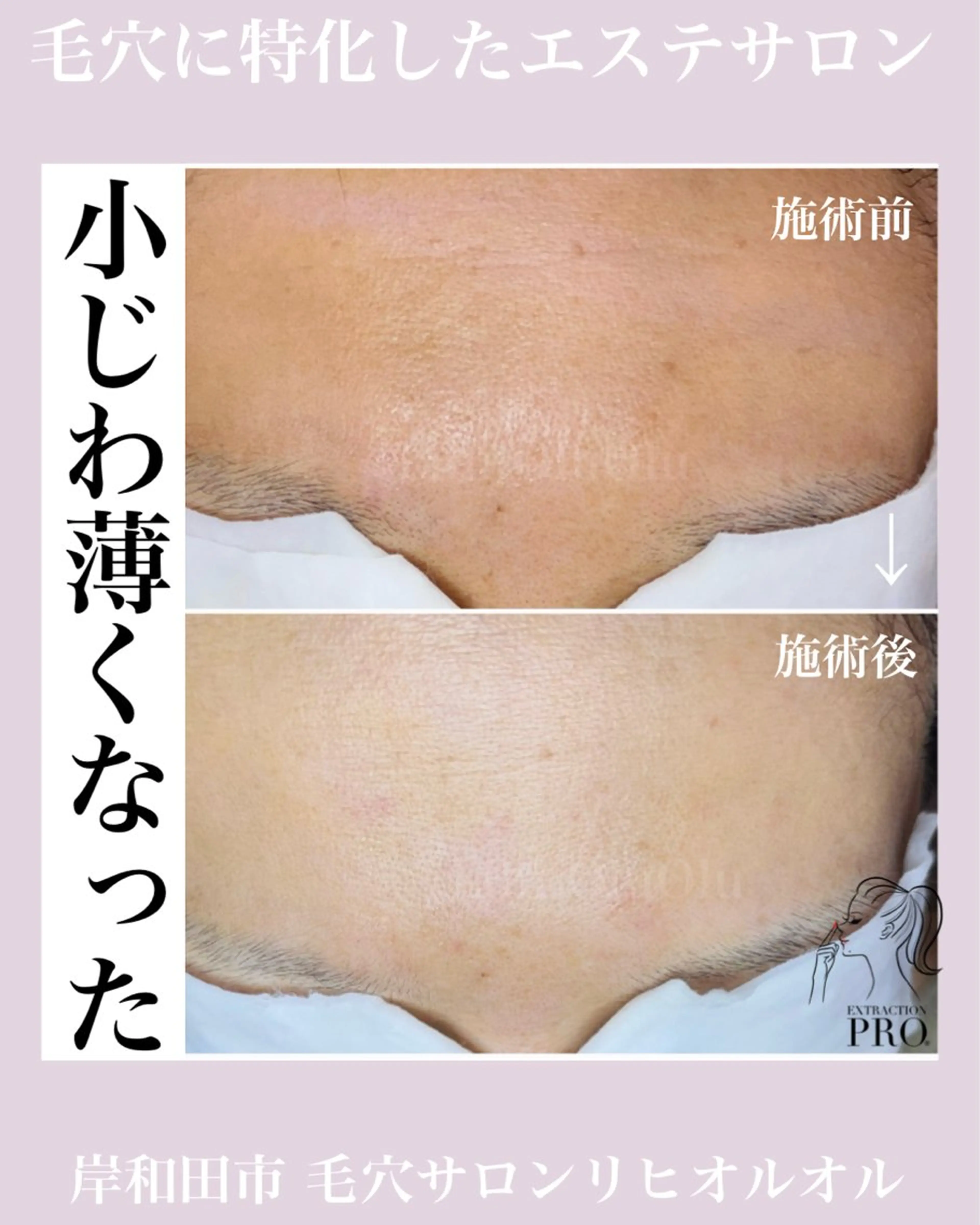 毛穴汚れ改善専門店/ 岸和田/リヒオルオルのエステ・リラクイメージ