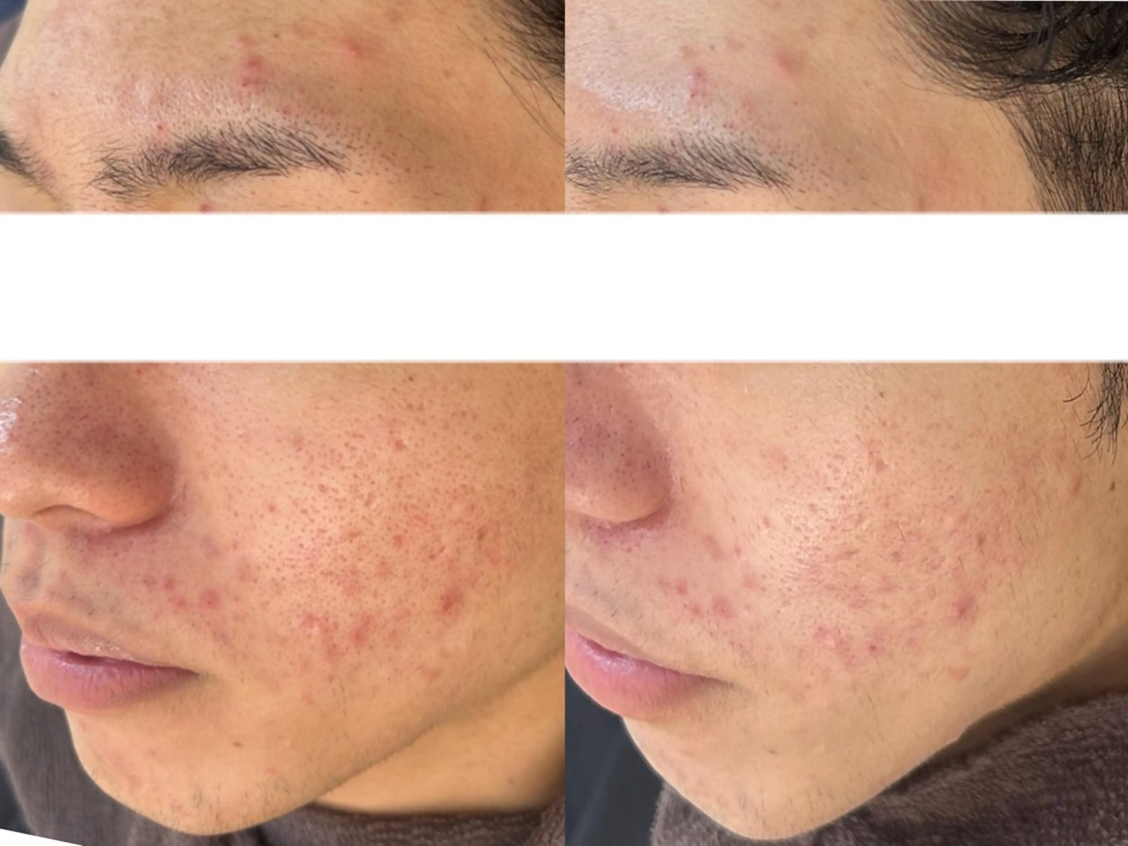 Belle beauty salon所属・Bellebeau tysalonのエステ・リラクイメージ