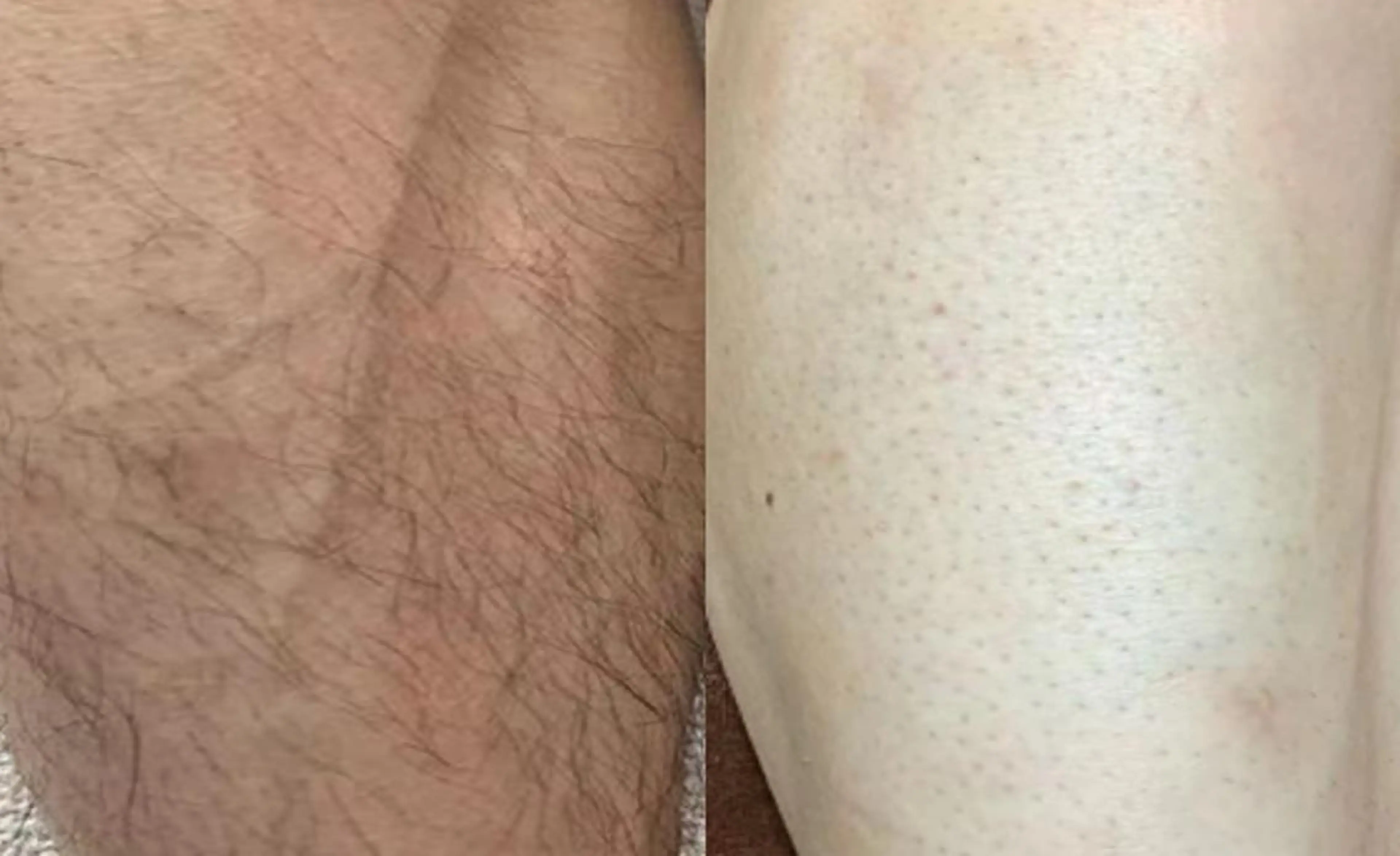 全身脱毛×マッサージ 高岳×新栄×代官町の眉毛・アイブロウイメージ