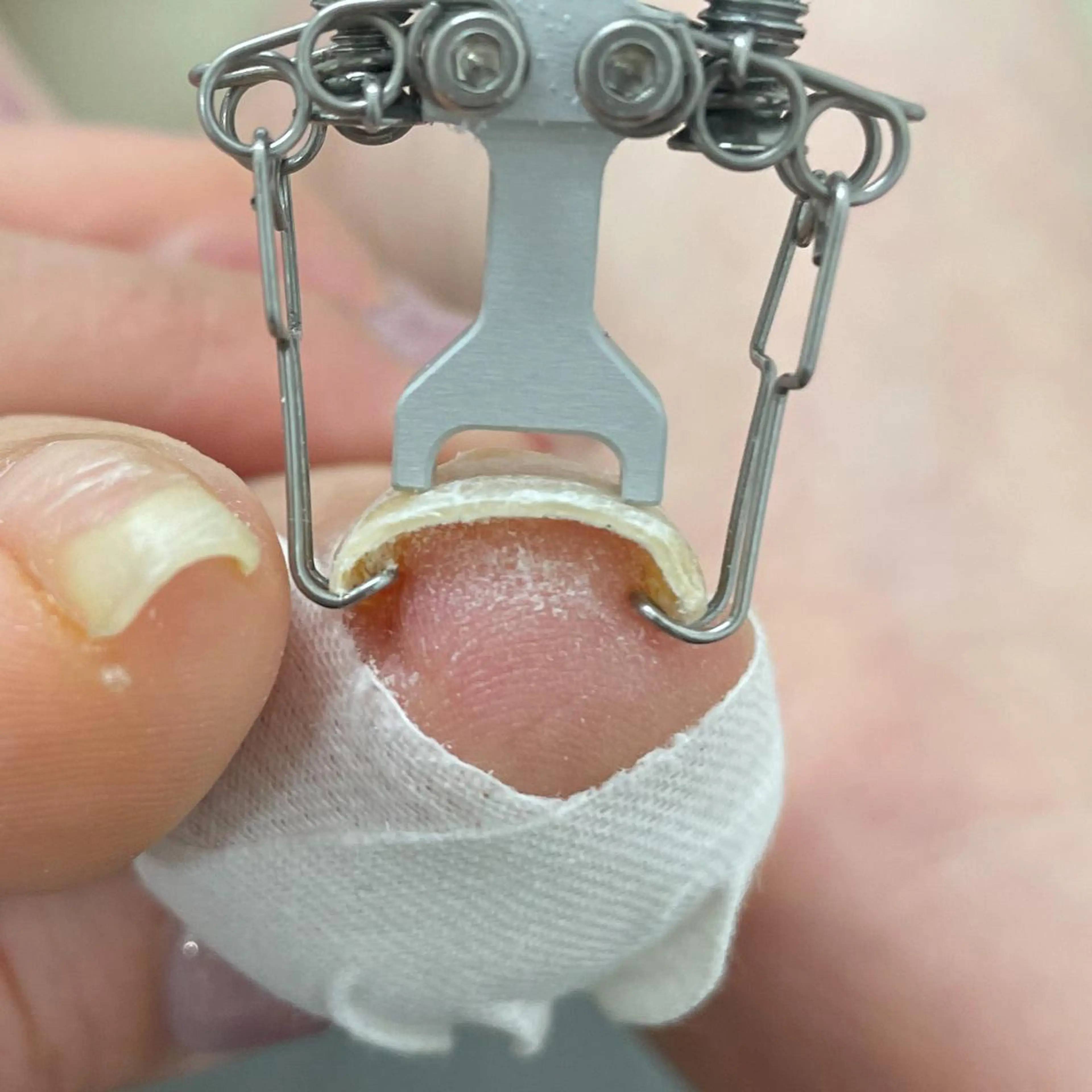 ネイル Bella  totalbeauty所属・Bella 齋藤理奈のネイルデザイン