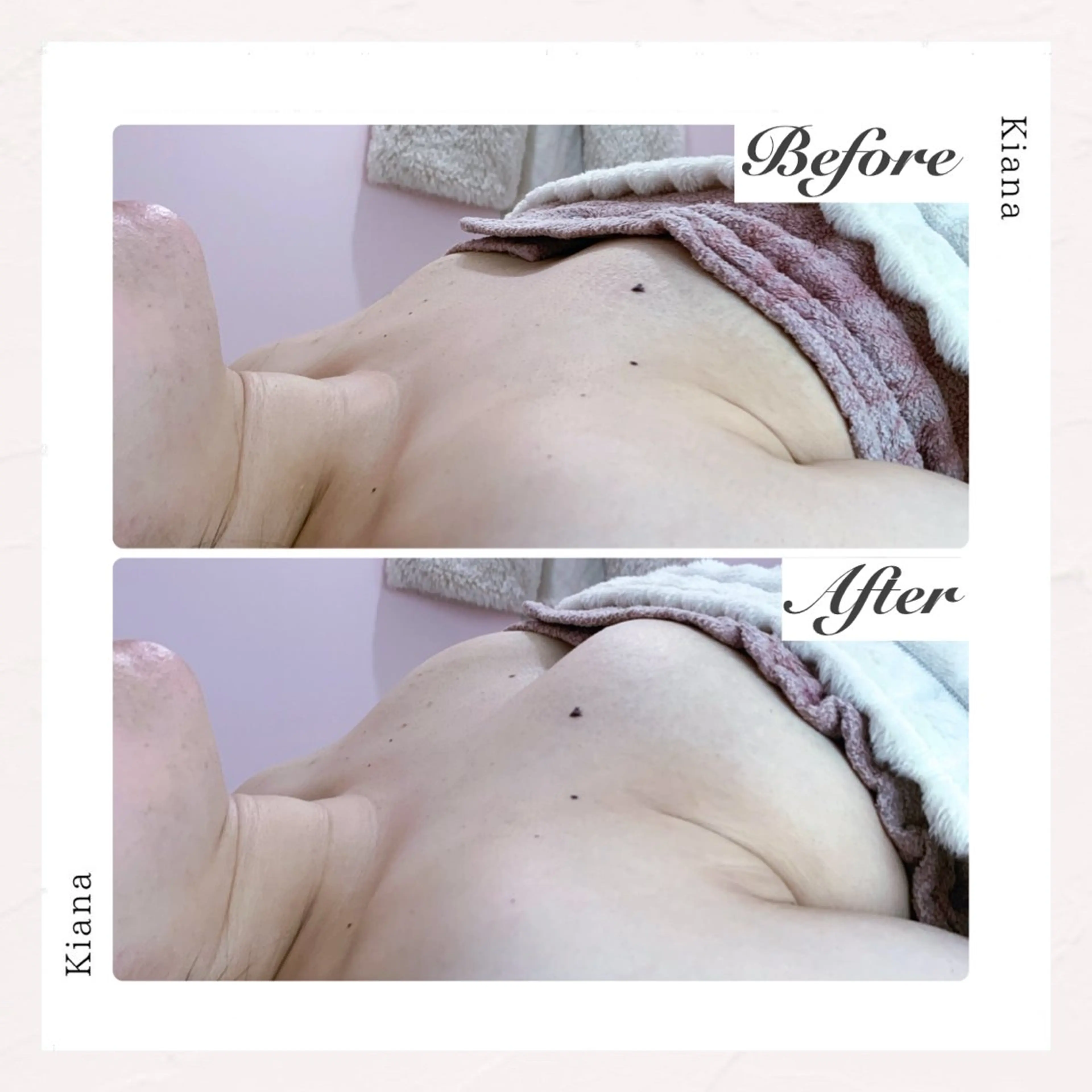 エステ リラク バスト専門Kiana 風のエステ・リラクイメージ