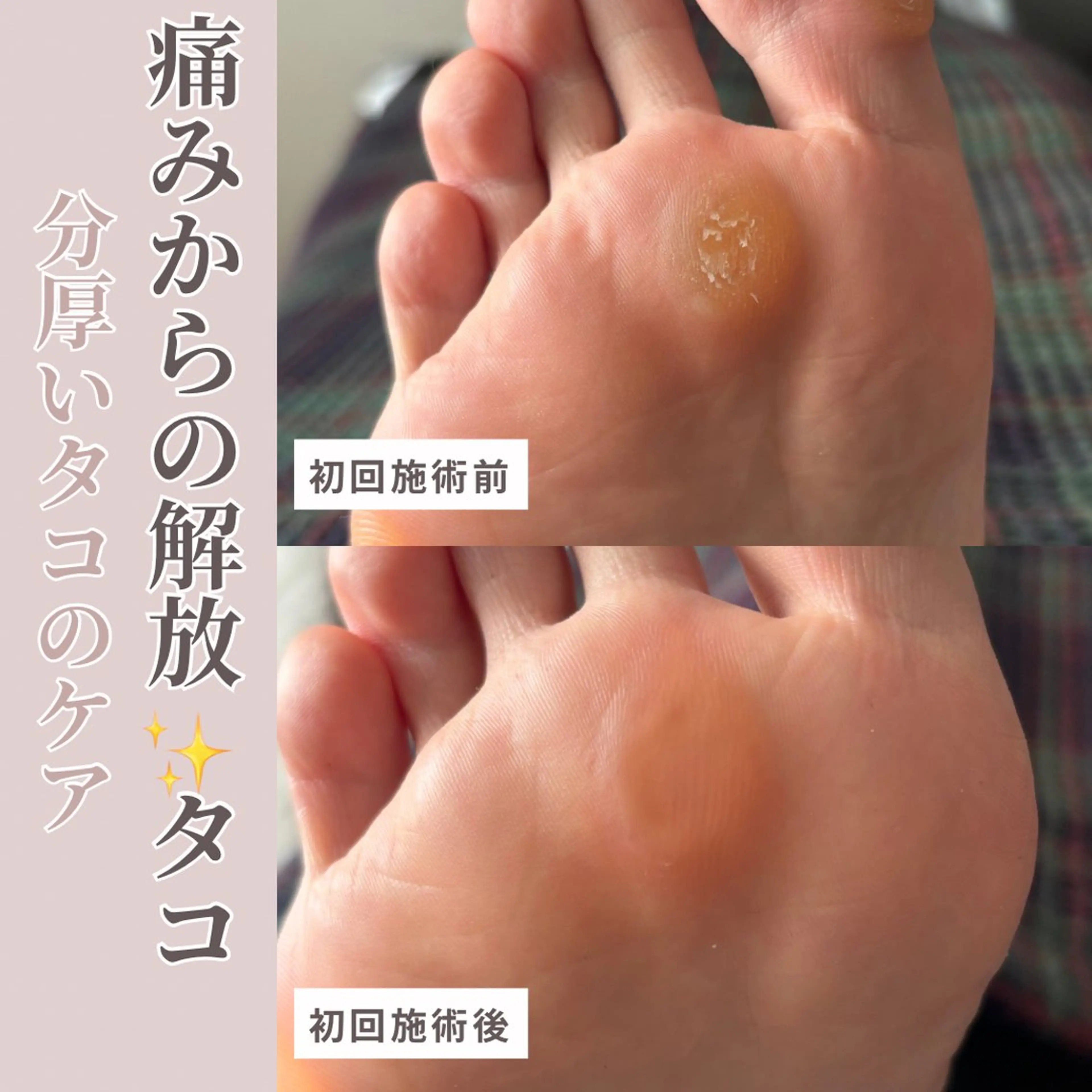 Studio Jivanのネイルデザイン