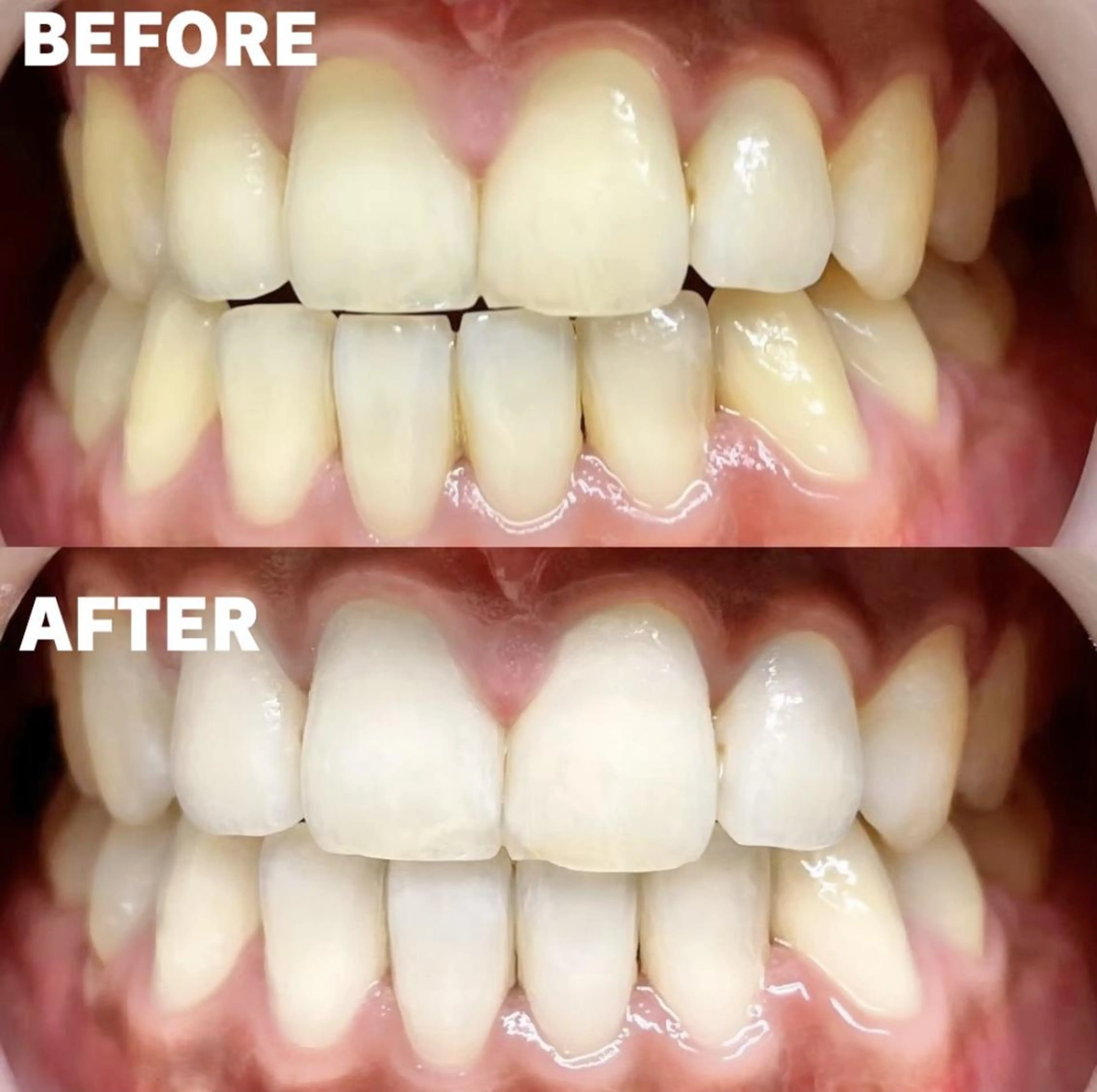 LBSホワイトニング 銀座店💎店長浦和のその他イメージ