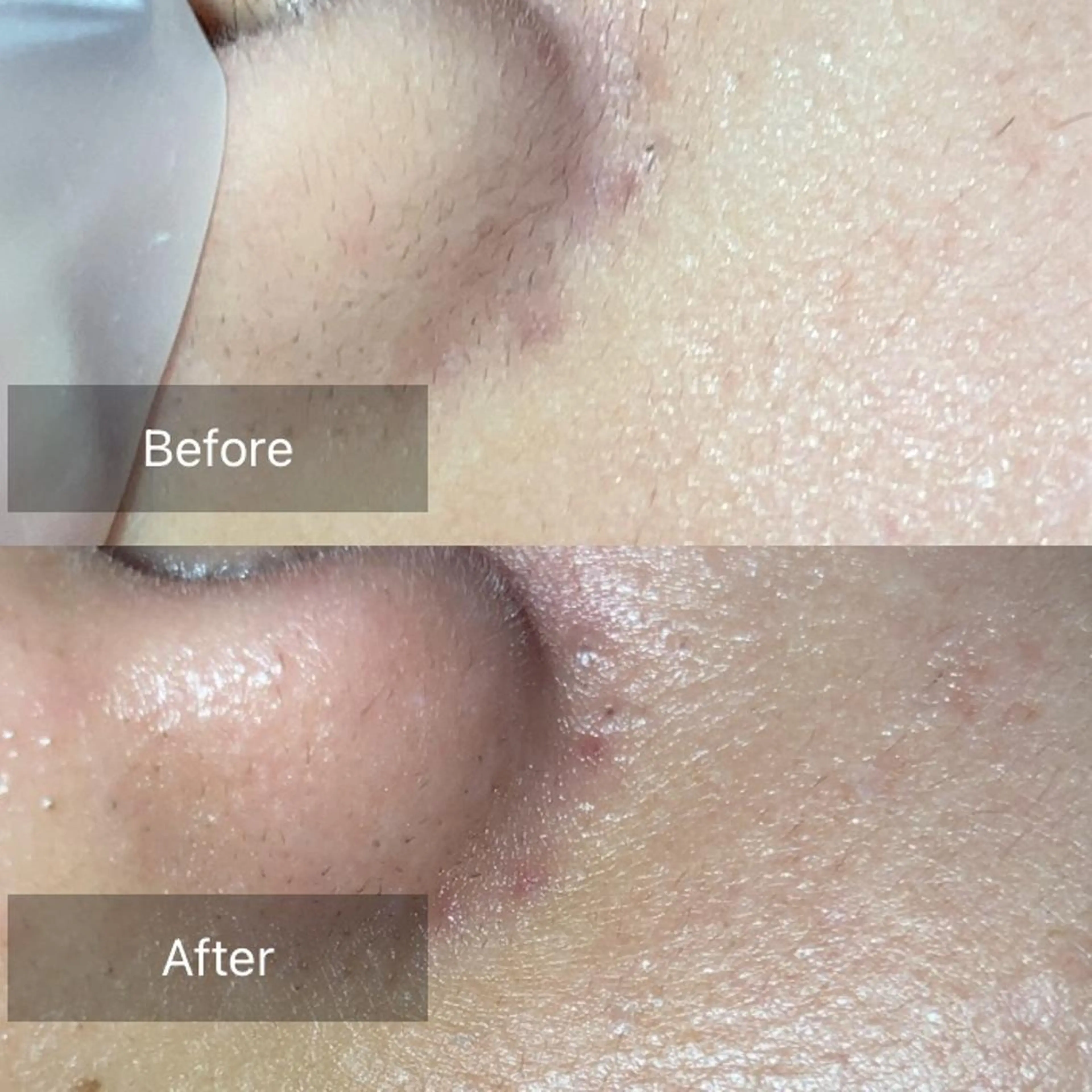 脱毛 産毛専門店 Bittoのエステ・リラクイメージ