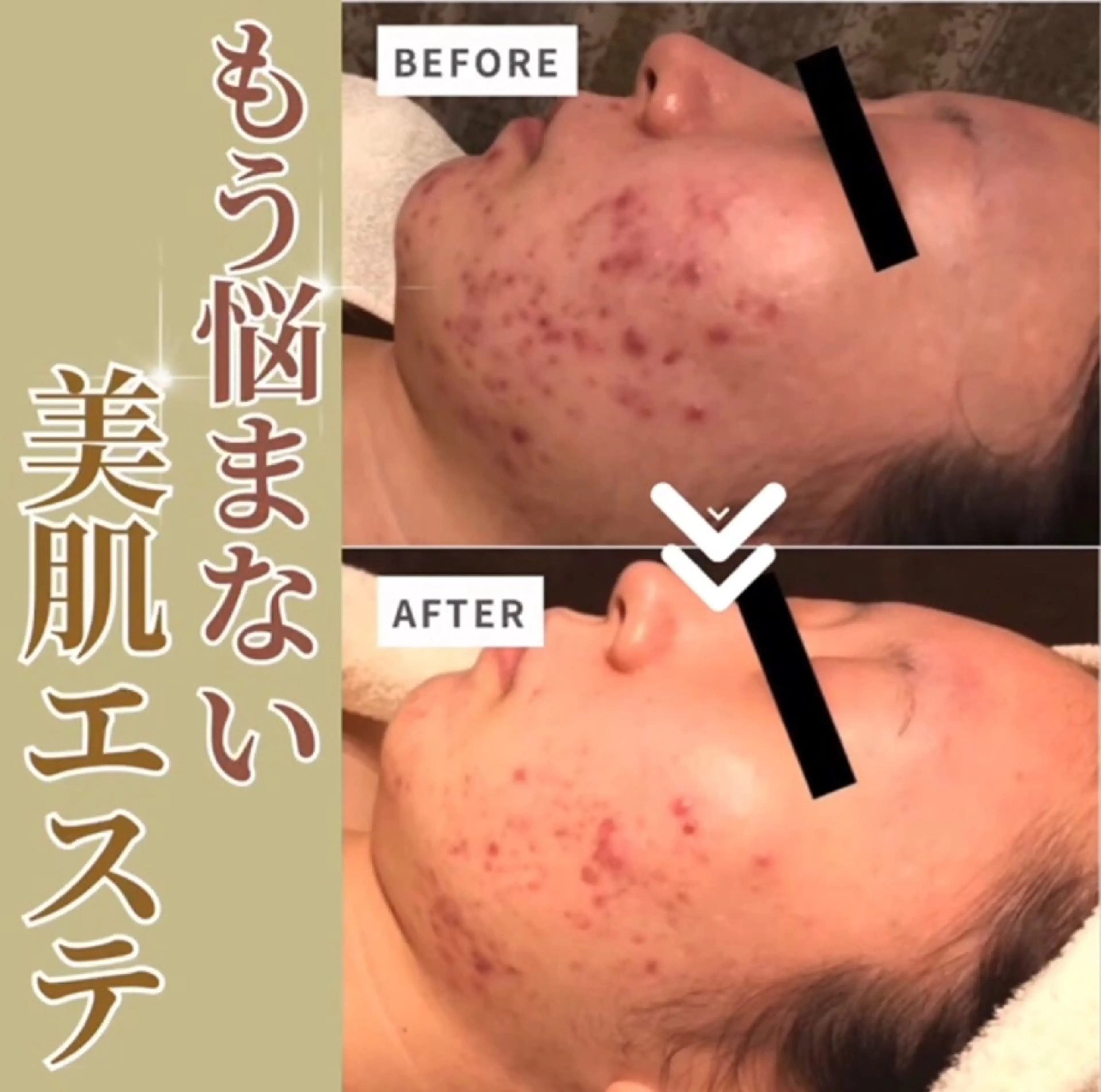 ミュージック＆オーガニックエステShalom5〜シャロームファイブ〜所属・オーガニックエステ Shalom5のエステ・リラクイメージ