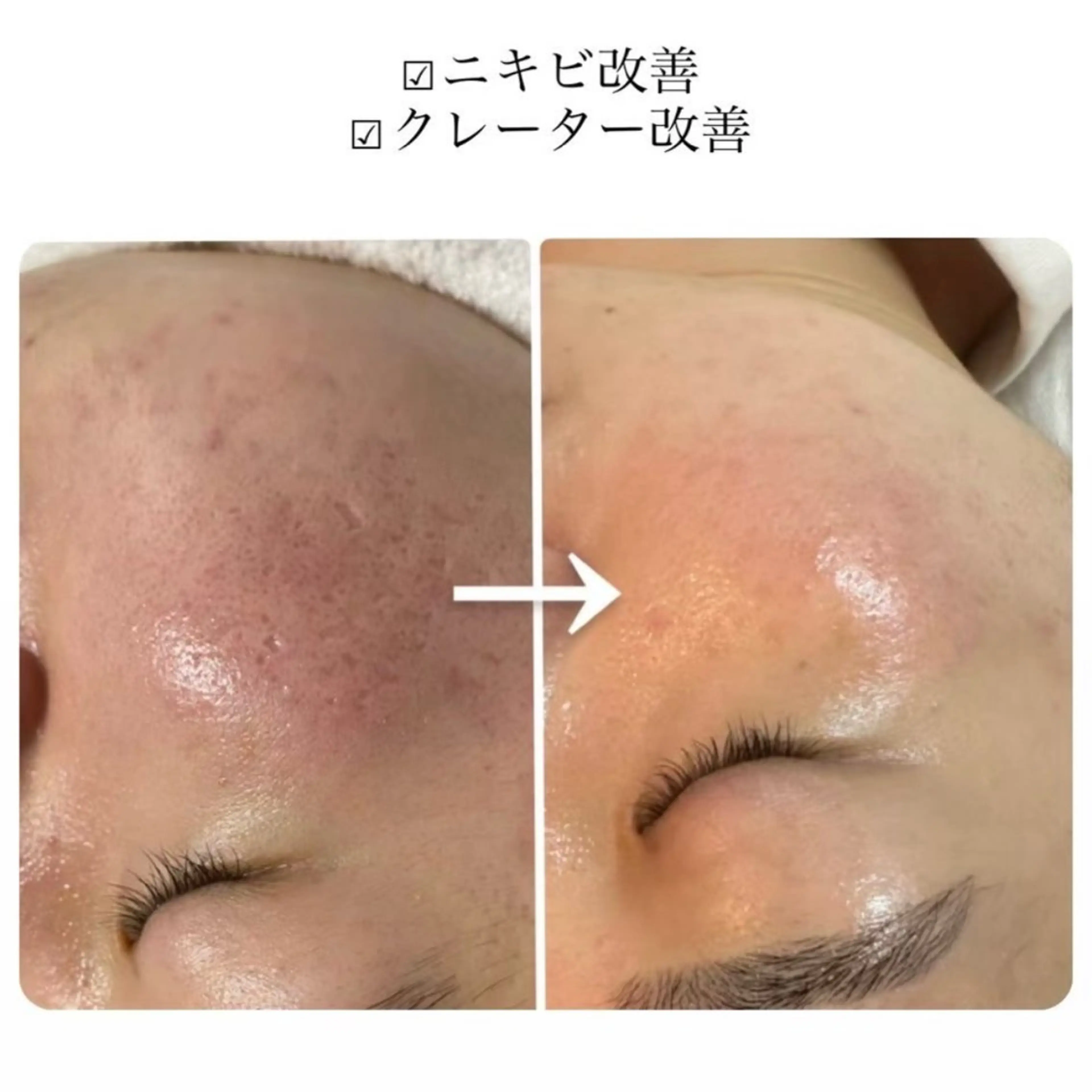 デ・アイム心斎橋所属・肌質改善サロン🫧 MAIのエステ・リラクイメージ