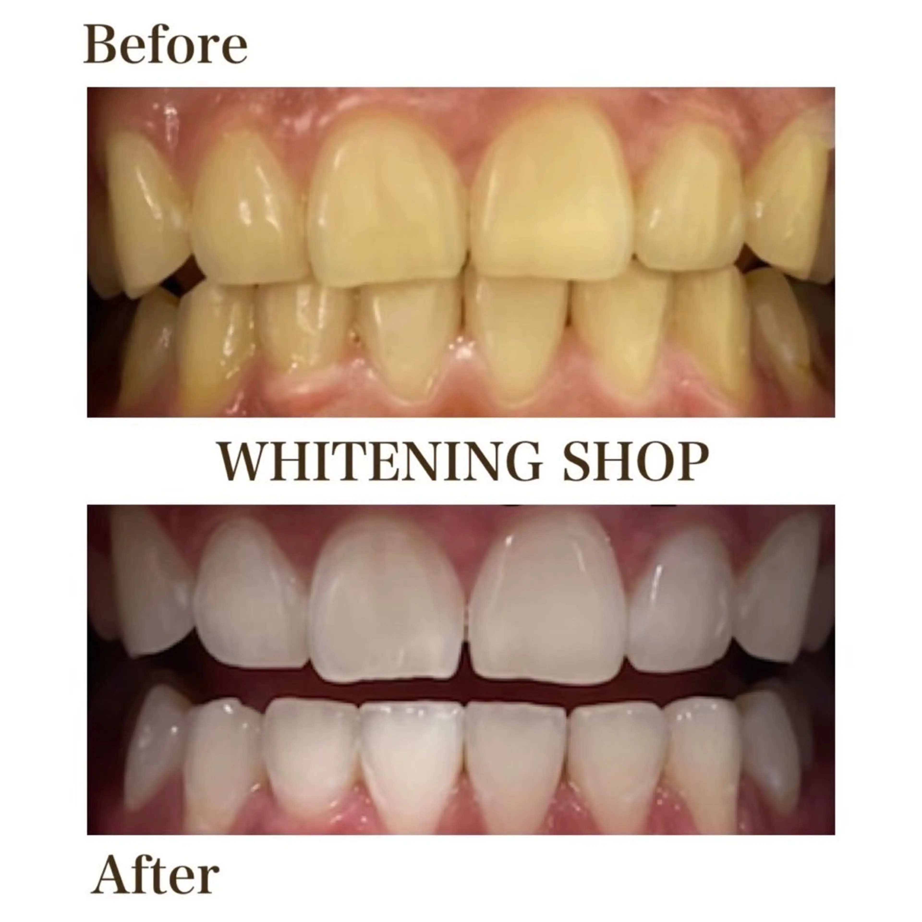 ホワイトニング ショップ川越店のエステ・リラクイメージ