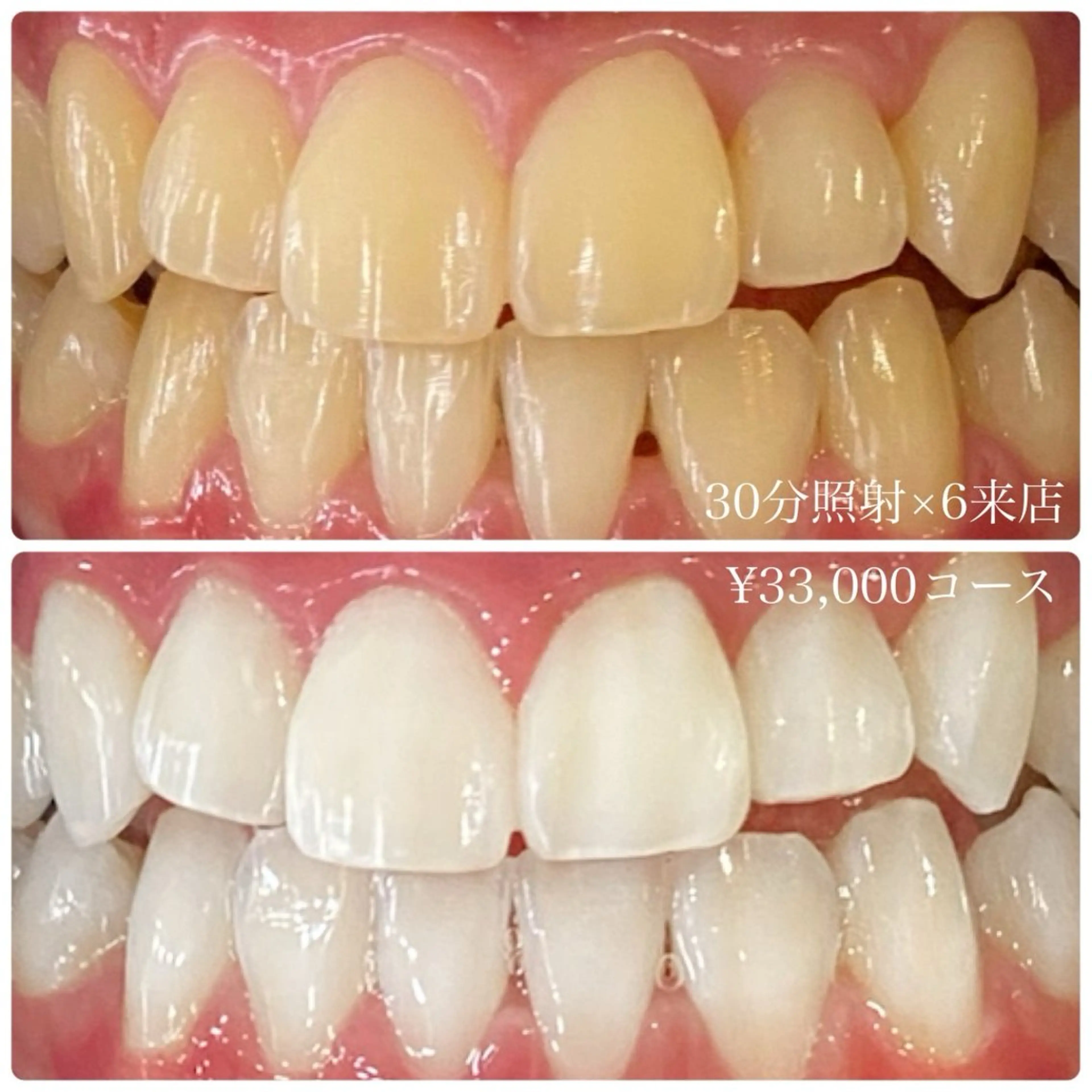 その他 PLATINUM Beauty 横浜店所属・ホワイトニングルーム 横浜店のその他イメージ