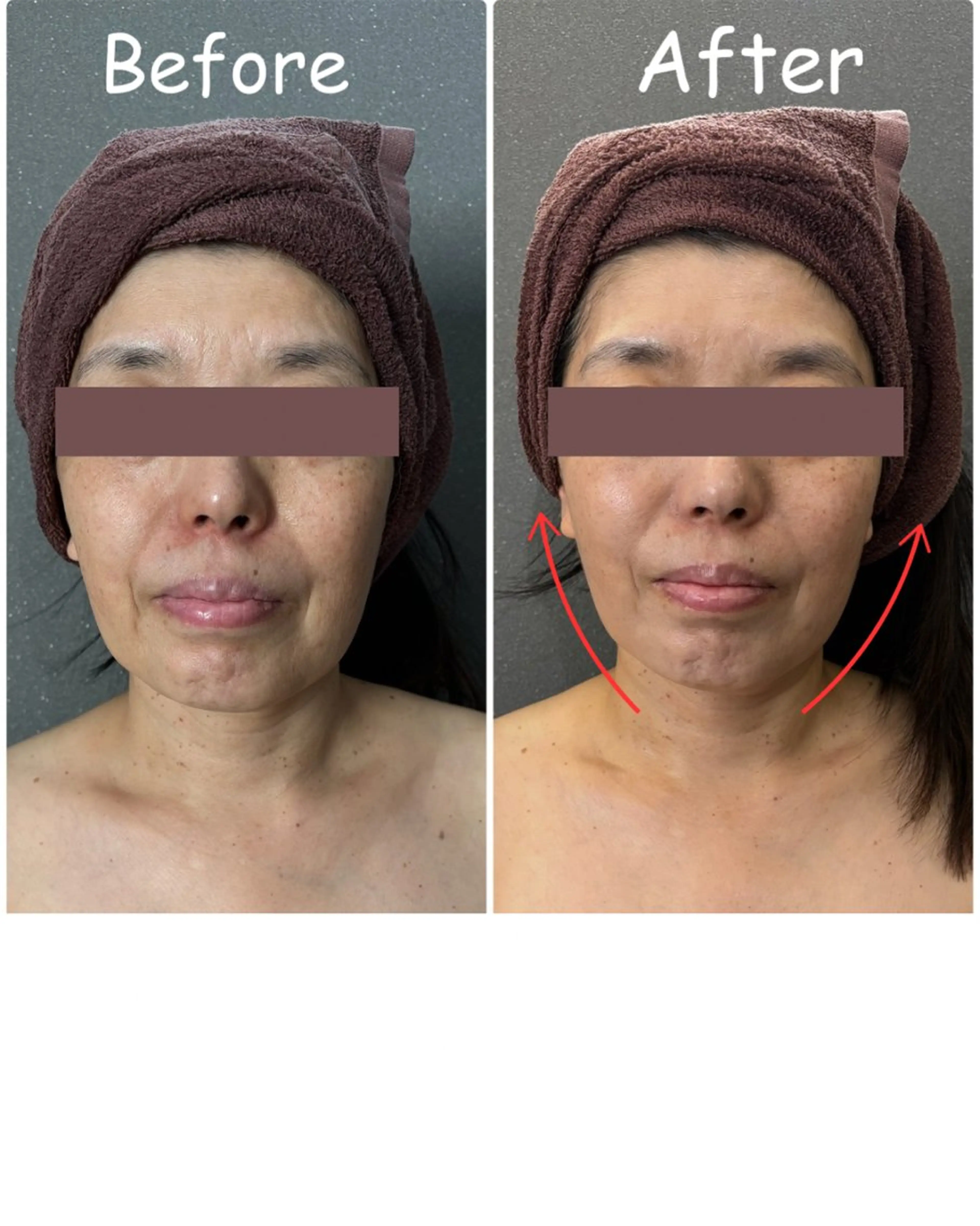 Eminy by  L★sのエステ・リラクイメージ