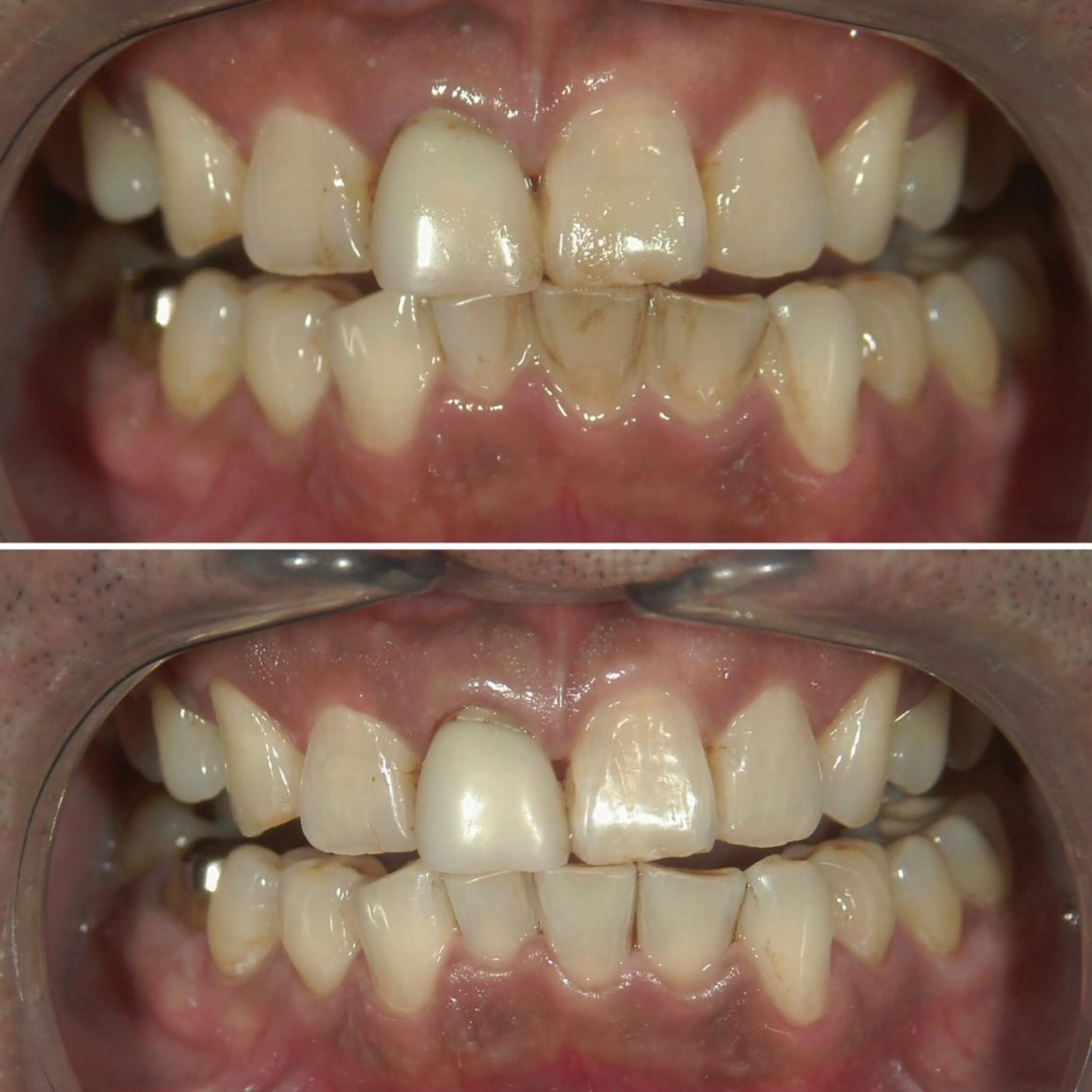 メンズ キッズ 217whitening  room所属・217 ホワイトニングルームのエステ・リラクイメージ