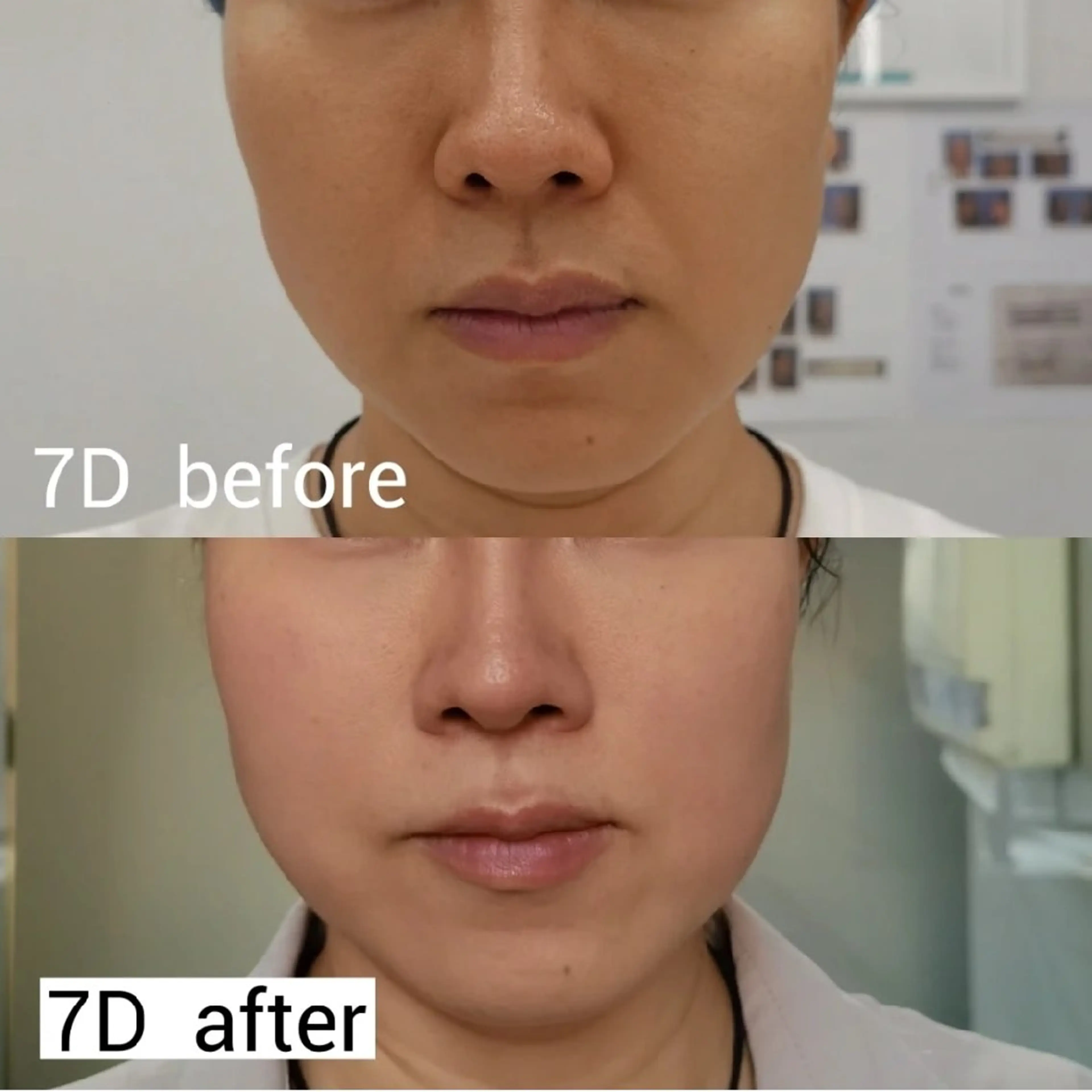 マツエク・マツパ 結婚式・ブライダル aliaハイフ&水光ジェットサロン所属・aliaハーブ水光店 エステティシャン募集のエステ・リラクイメージ