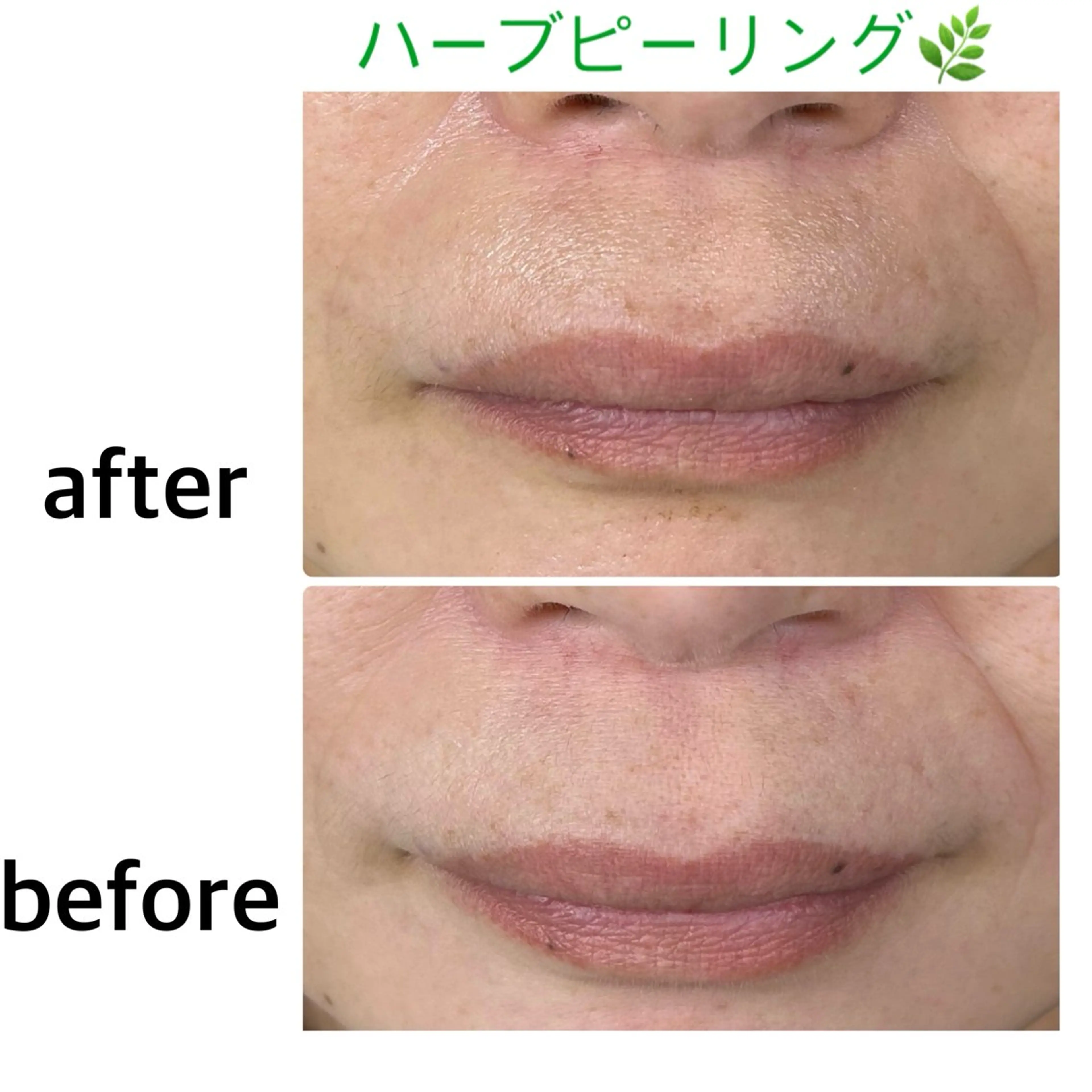 エステ soposilma 🧸今季OPENのマツエク・マツパデザイン