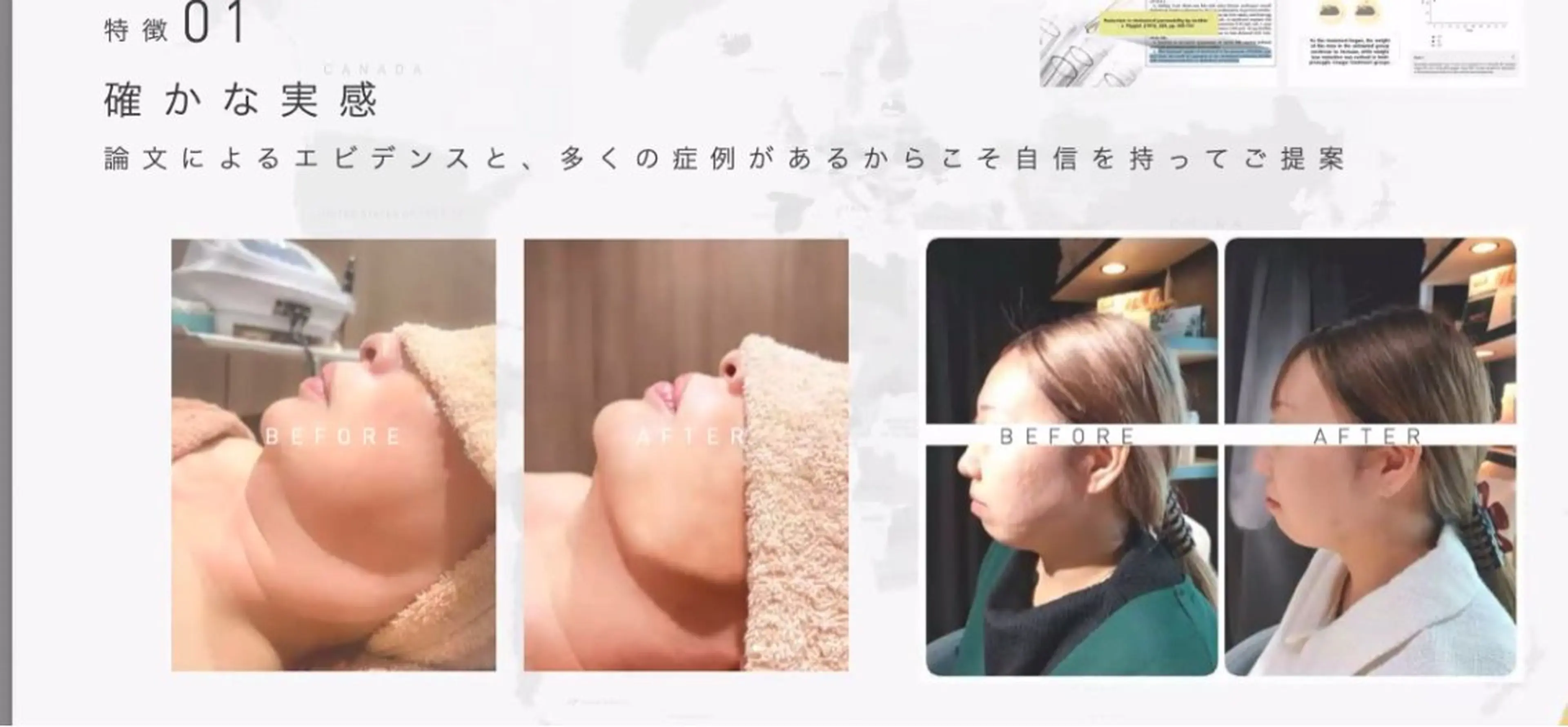 《新規限定》世界各国で大人気の韓国発祥🇰🇷ポレーションで導入🍋小顔速攻の写真