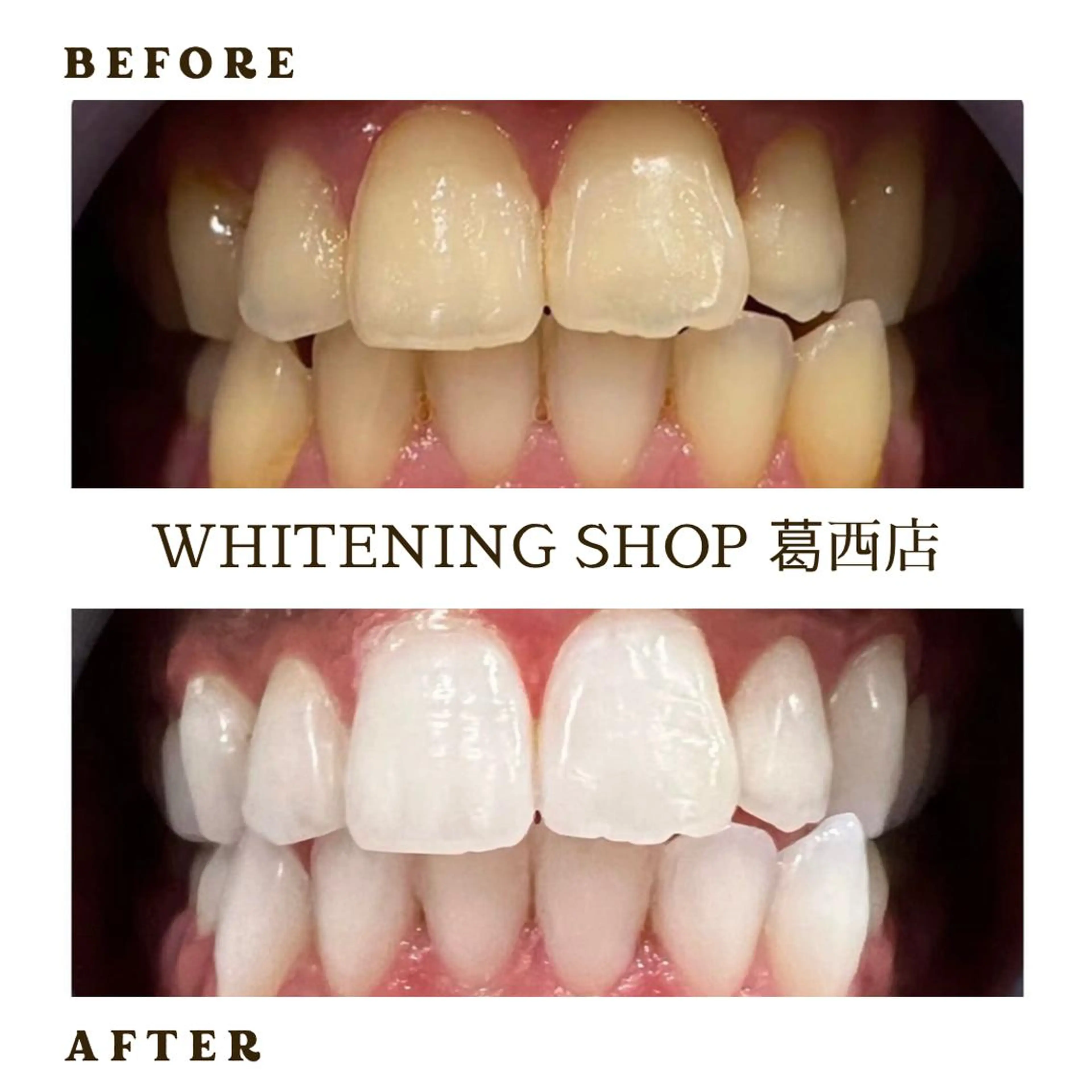 メンズ ホワイトニング ショップ葛西店のその他イメージ