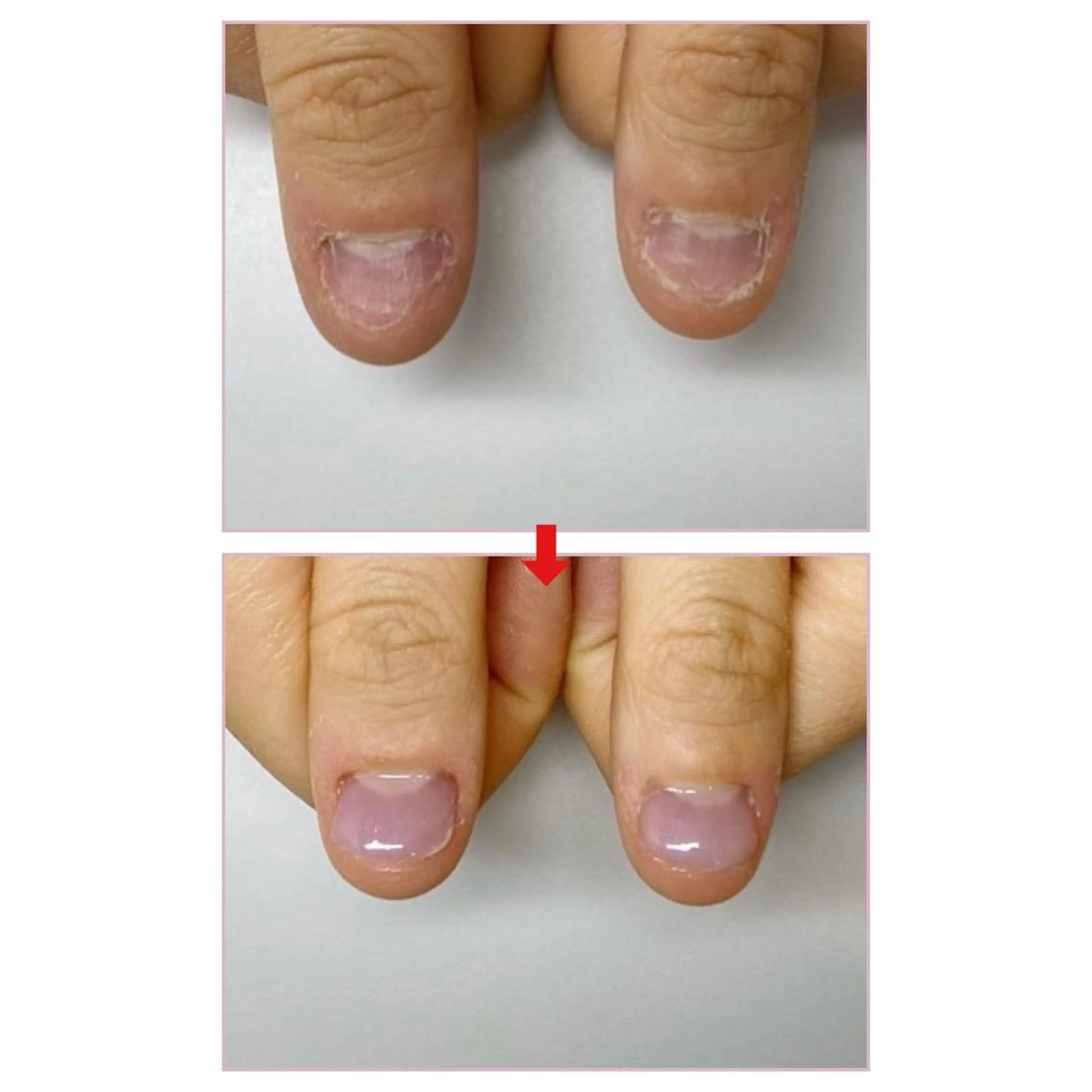 ネイル ネイルサロンアリューム所属・ネイルサロン アリュームのネイルデザイン