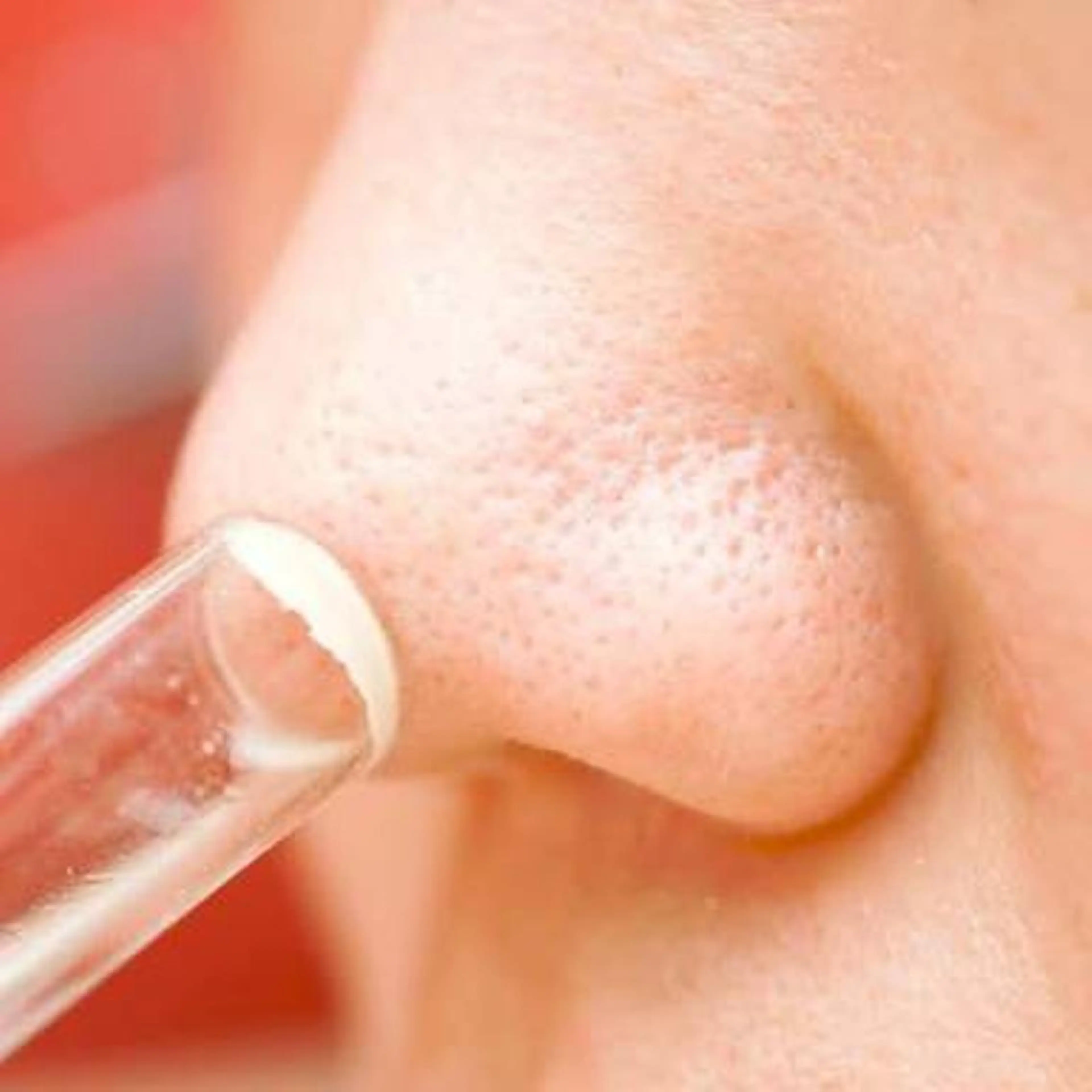 【ツルツル肌に🎵】毛穴黒ずみ除去、引き締めフォト照射で毛穴レス肌へ♪☆70分￥10,800☆の写真