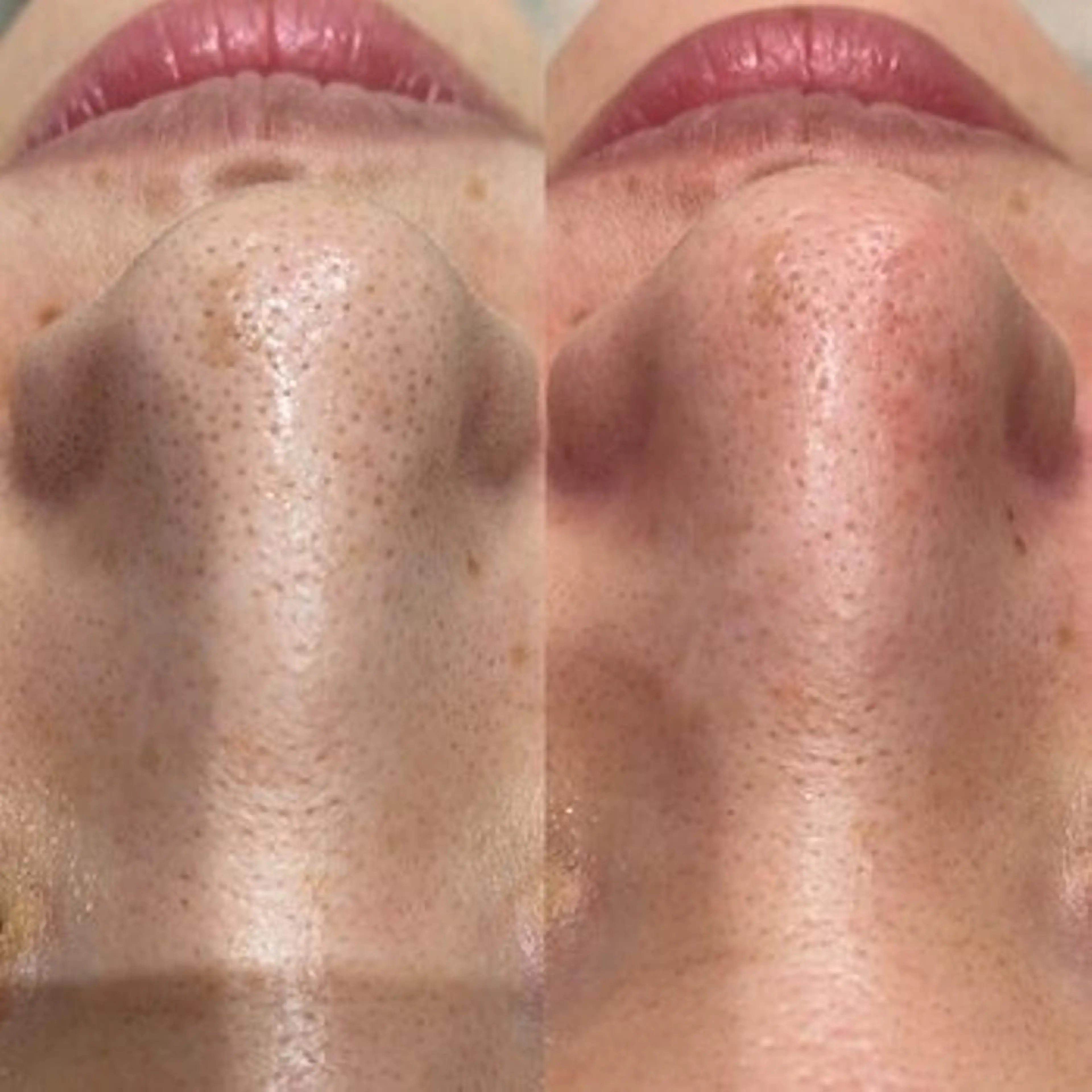 sii センター北 MANAのエステ・リラクイメージ