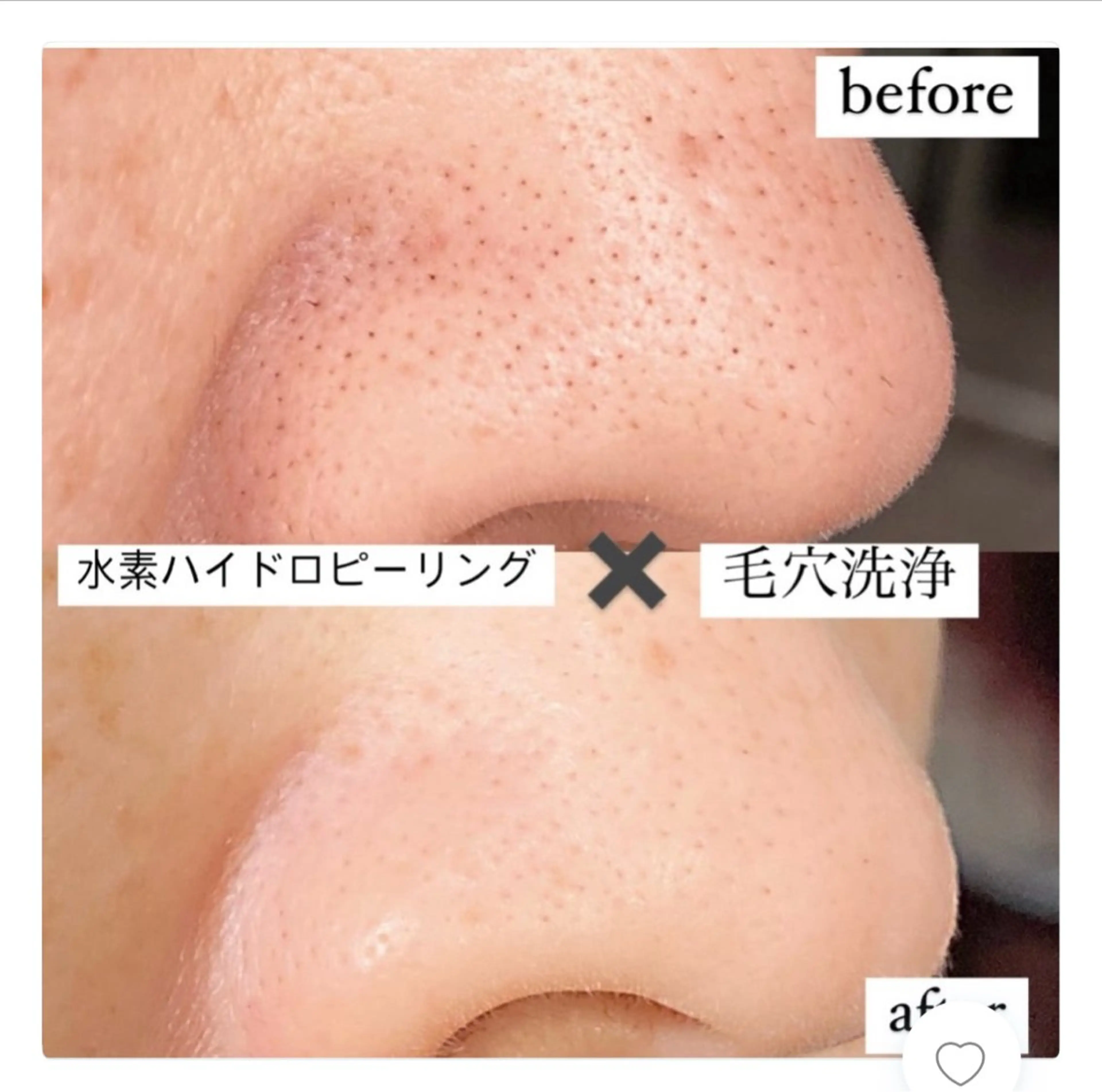 エステ Moana【モアナ】 HIROのエステ・リラクイメージ