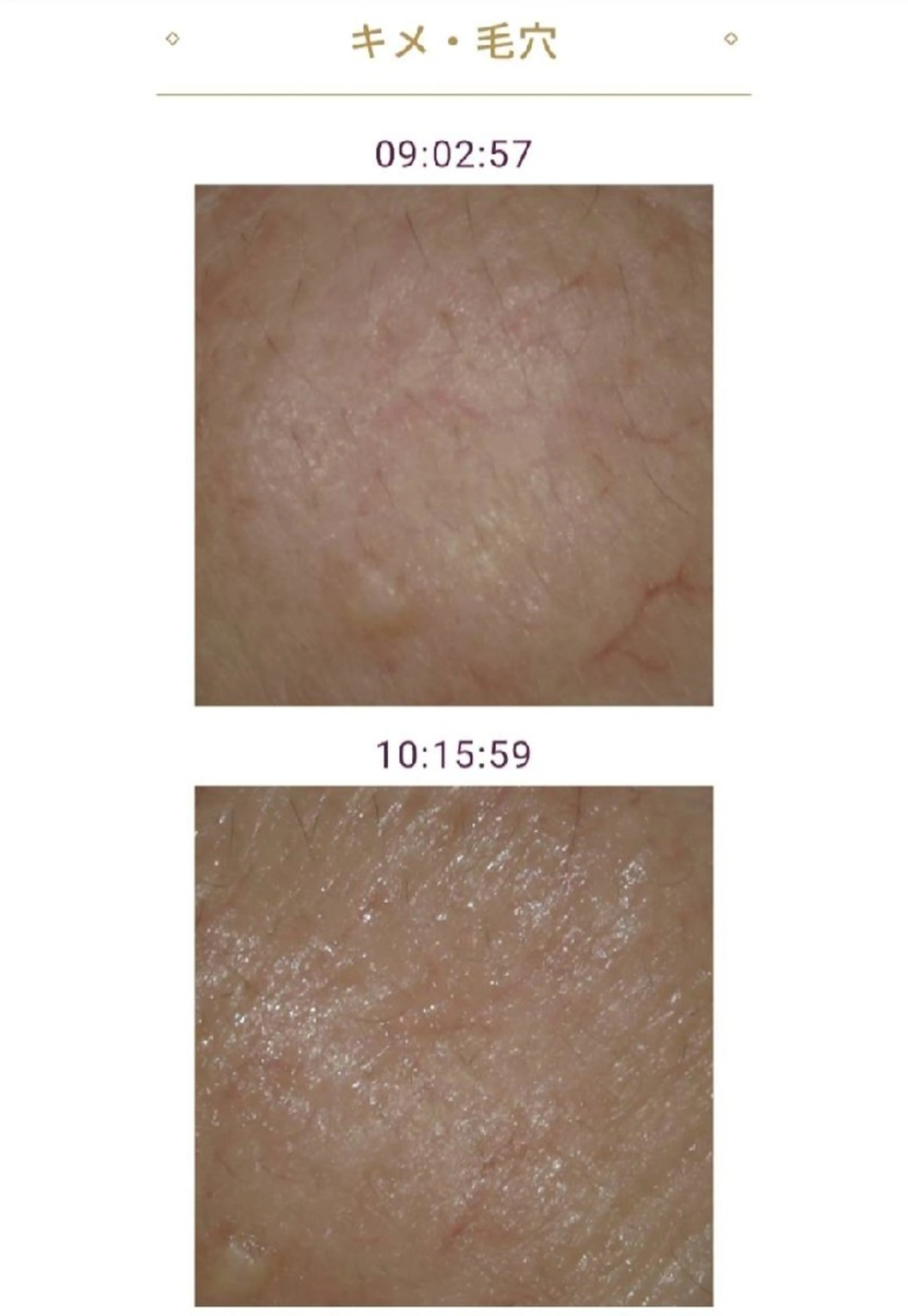 メナードフェイシャルサロンライズミュー所属・鈴木 由美のエステ・リラクイメージ