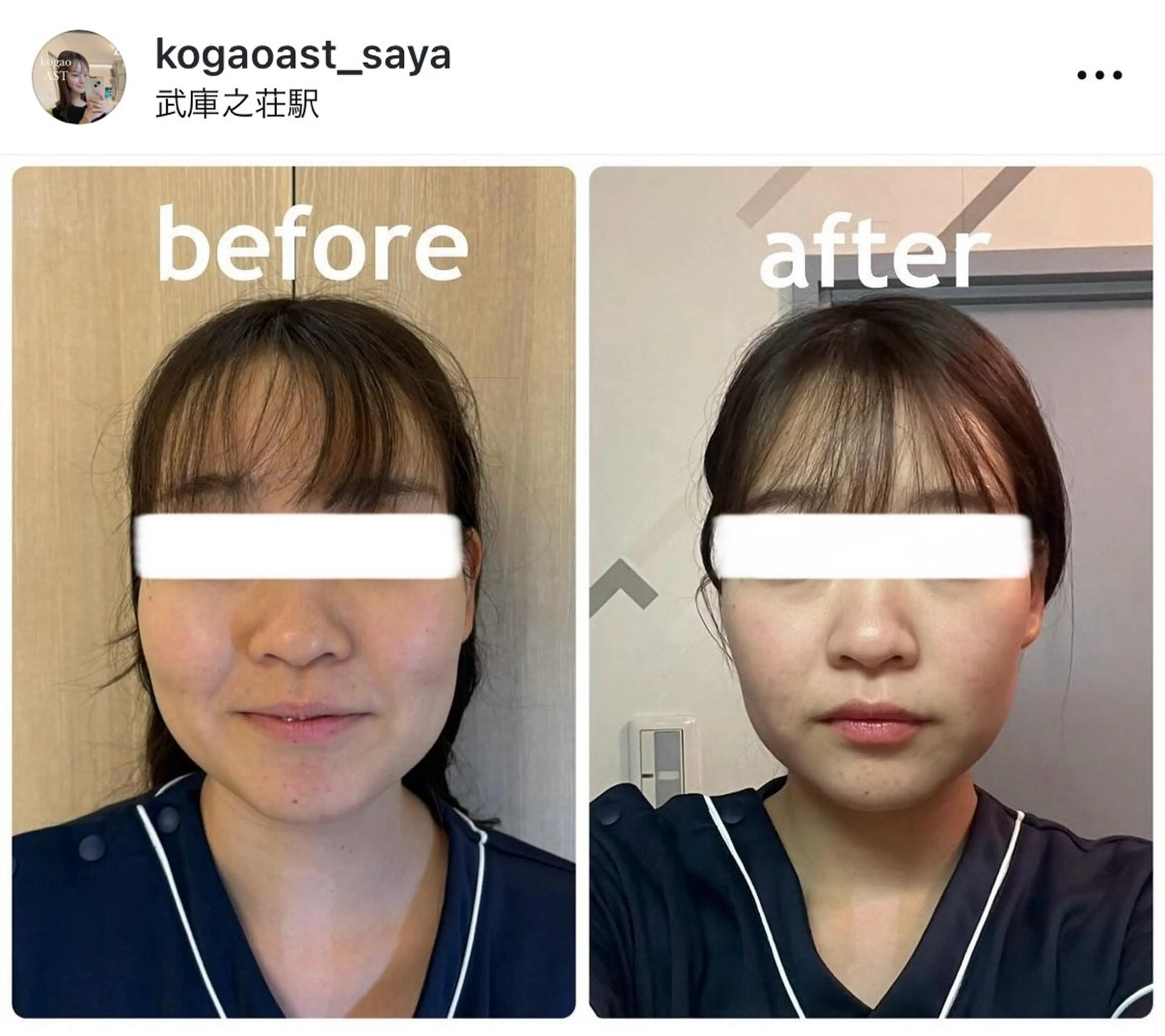 その他 小顔矯正サロンAST【アスト】所属・小顔矯正サロン AST【アスト】のその他イメージ