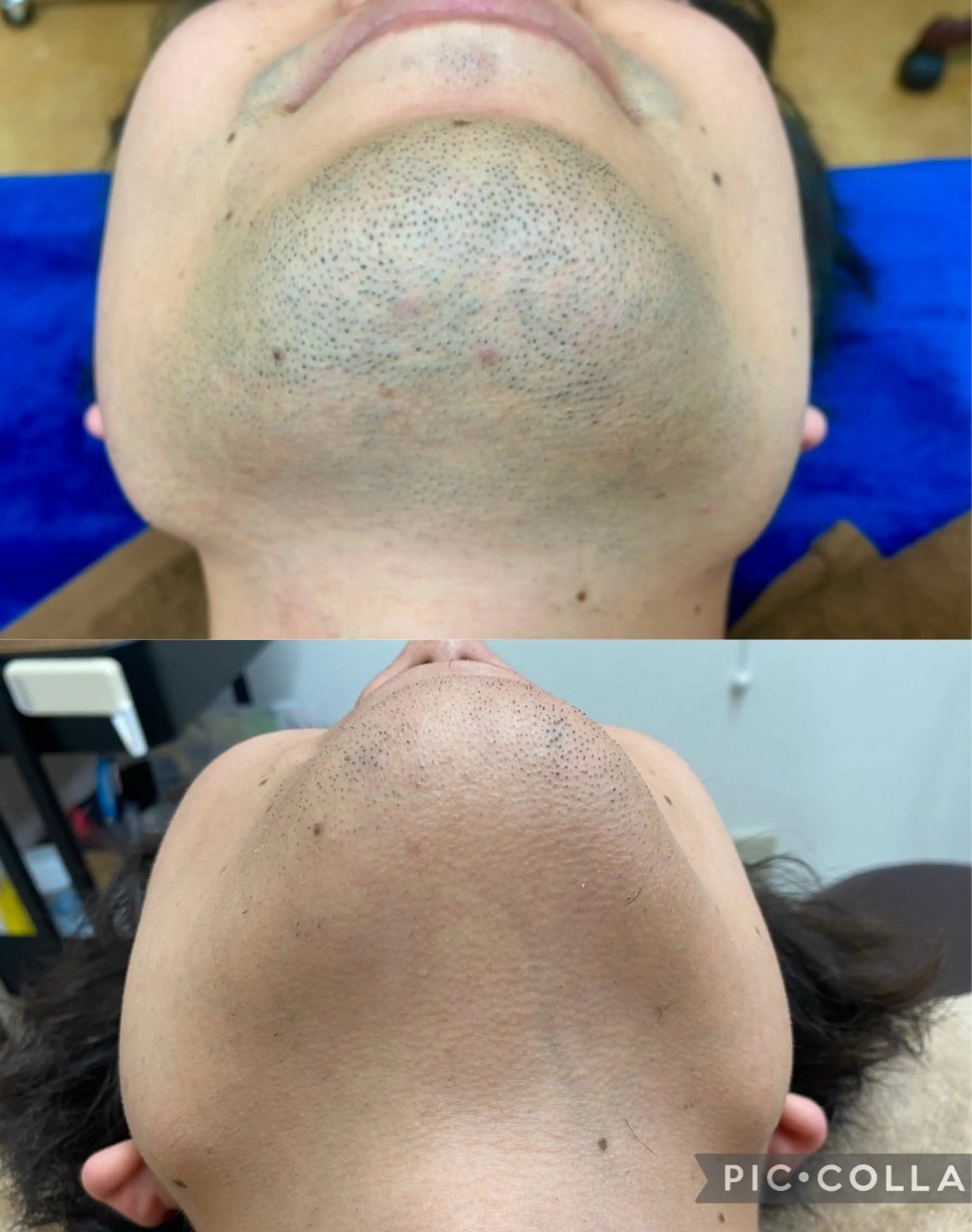 メンズ RE:moom リムーム/脱毛エステのエステ・リラクイメージ