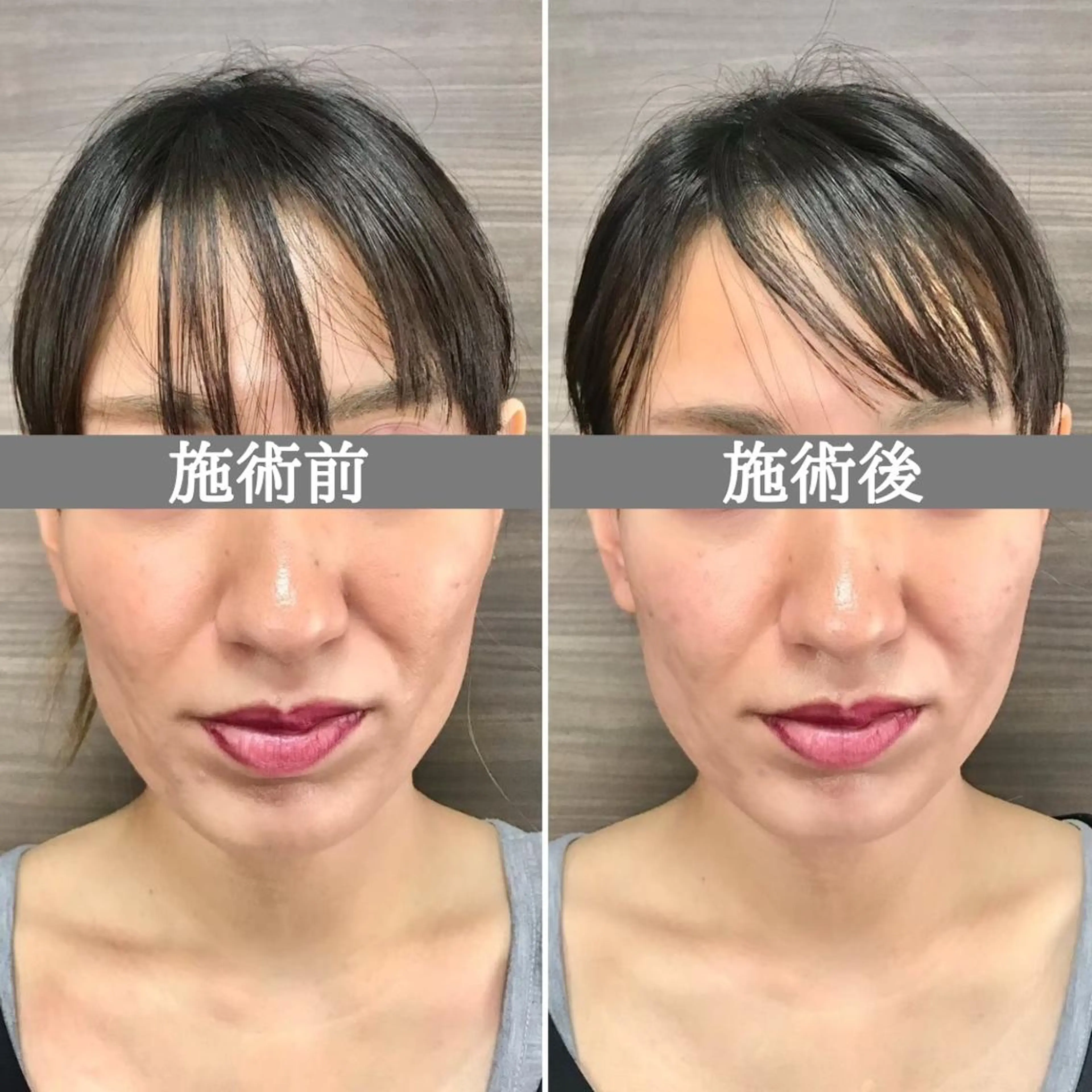 エステ リラク 美容整体サロン Chare人形町店のエステ・リラクイメージ