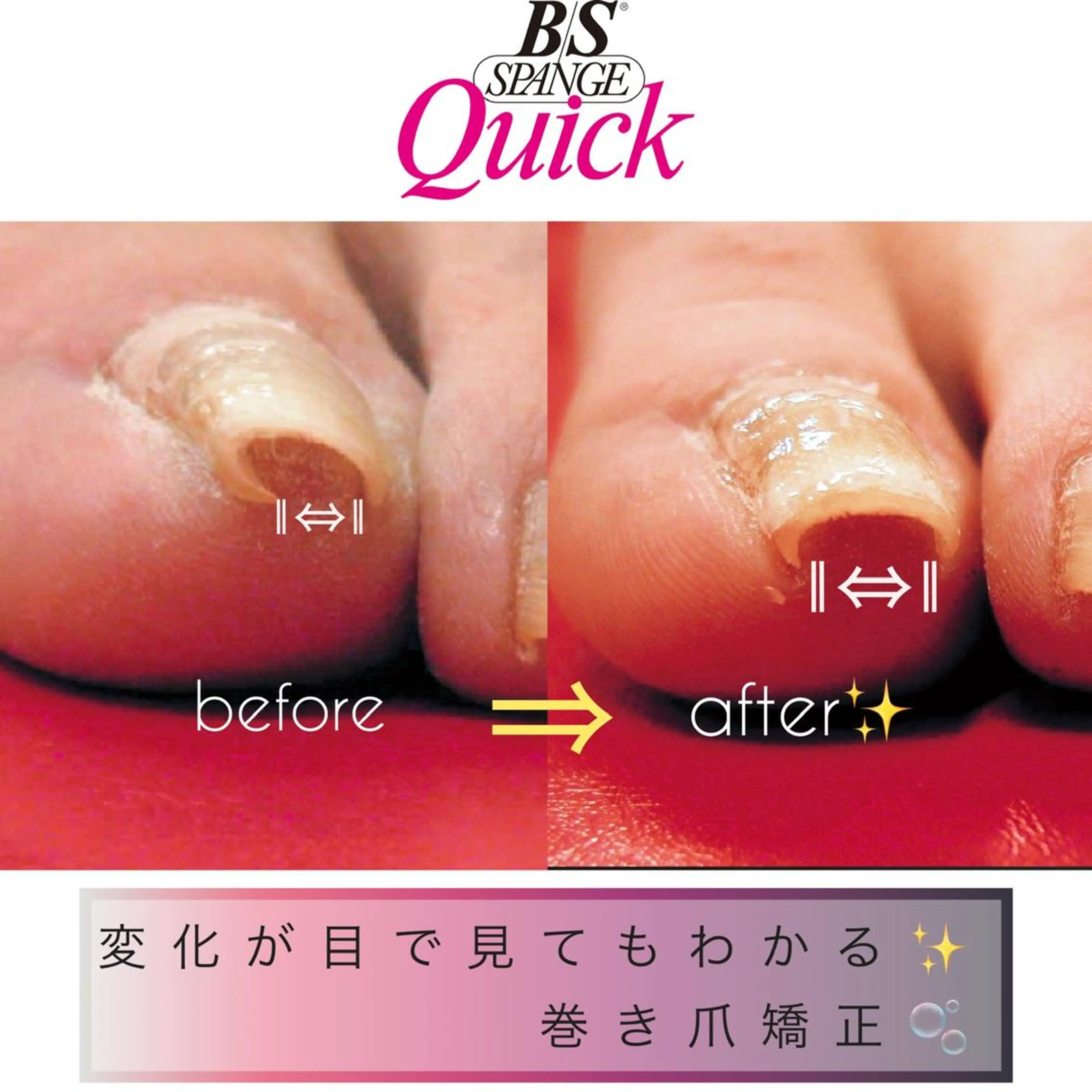 ネイル Tiara♛ティアラ 山口くるみのネイルデザイン