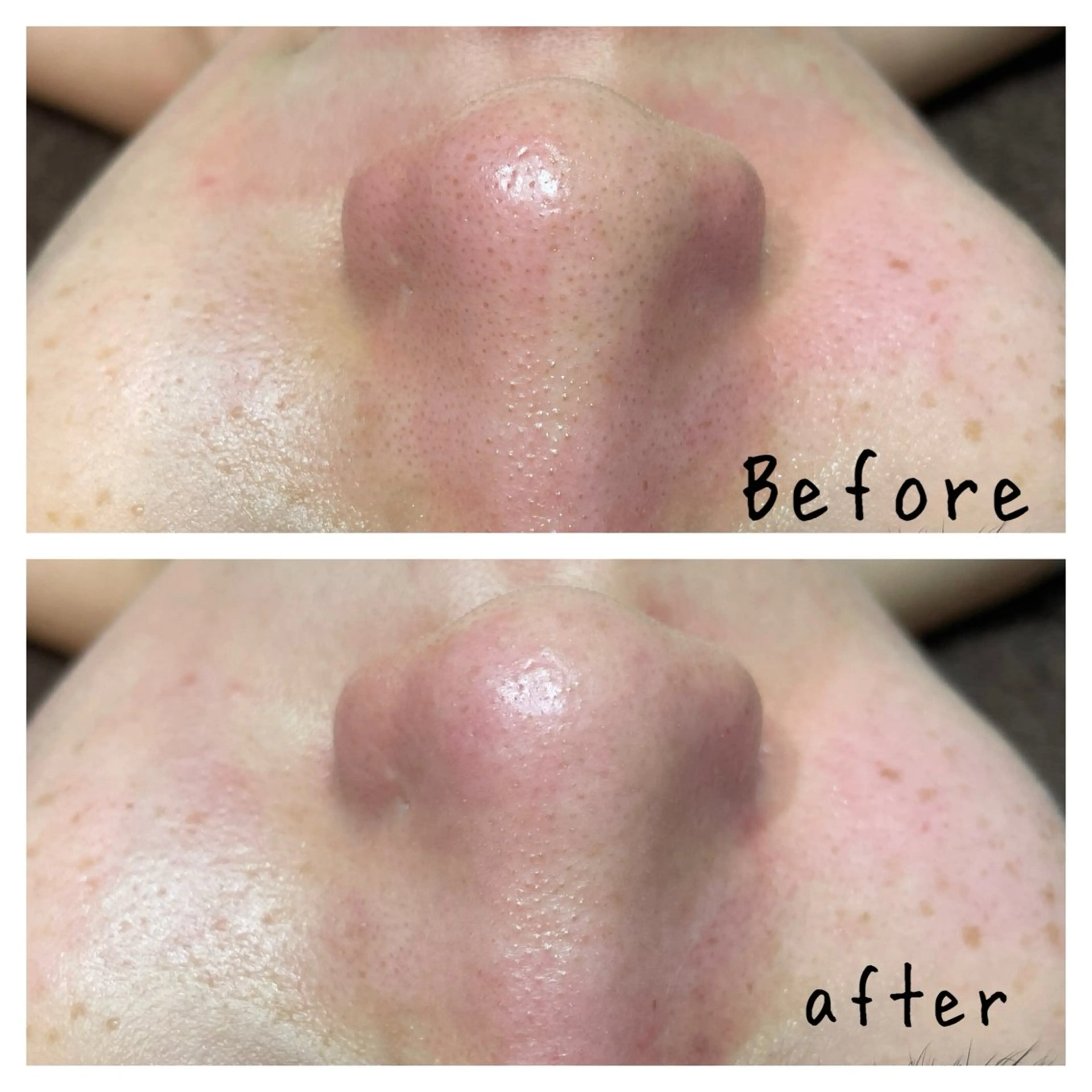 エステ 🎀kaede🎀 骨格似合わせ眉毛の眉毛・アイブロウイメージ