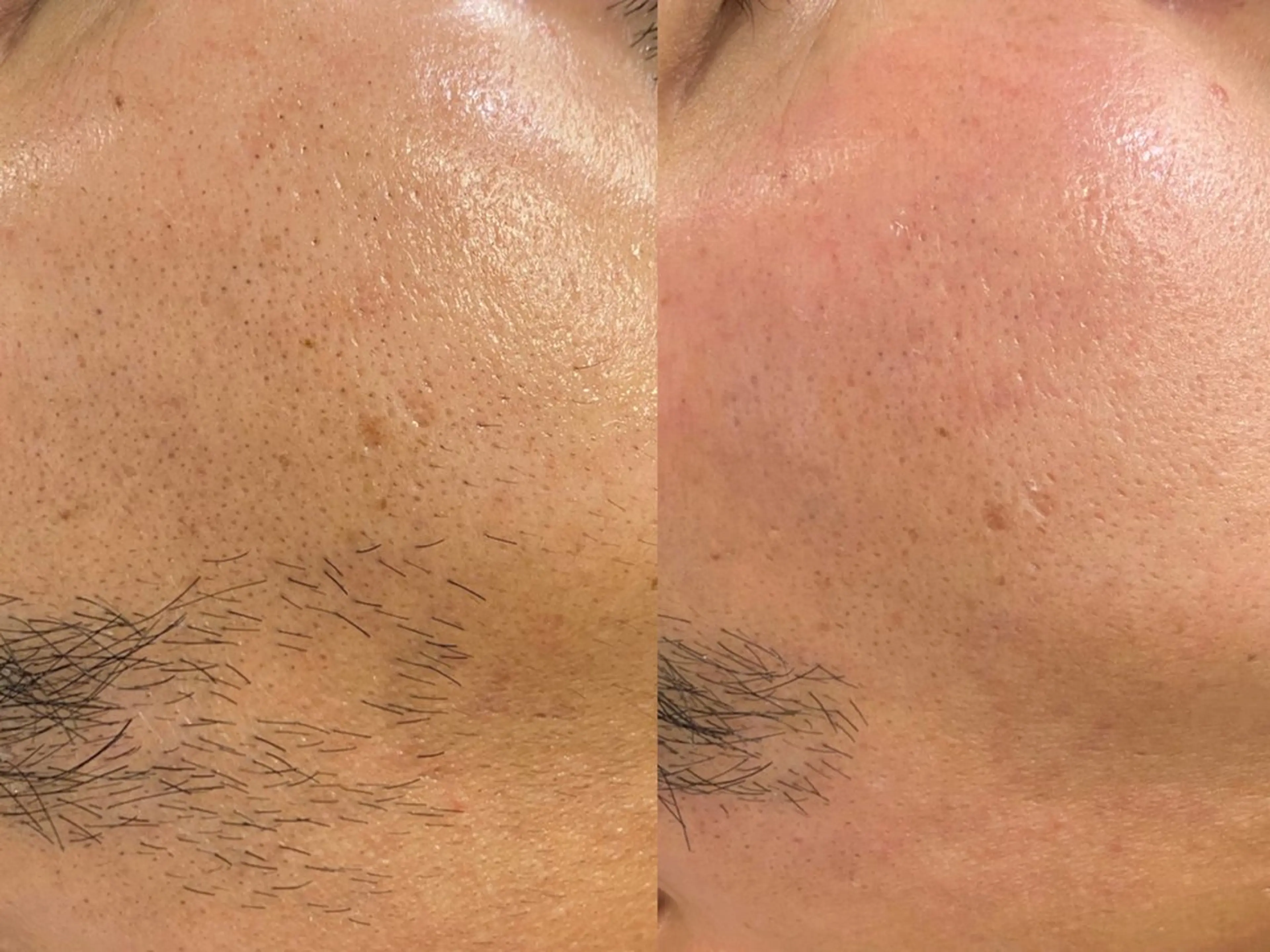 Morphome所属・【Morphome】 hinaのエステ・リラクイメージ