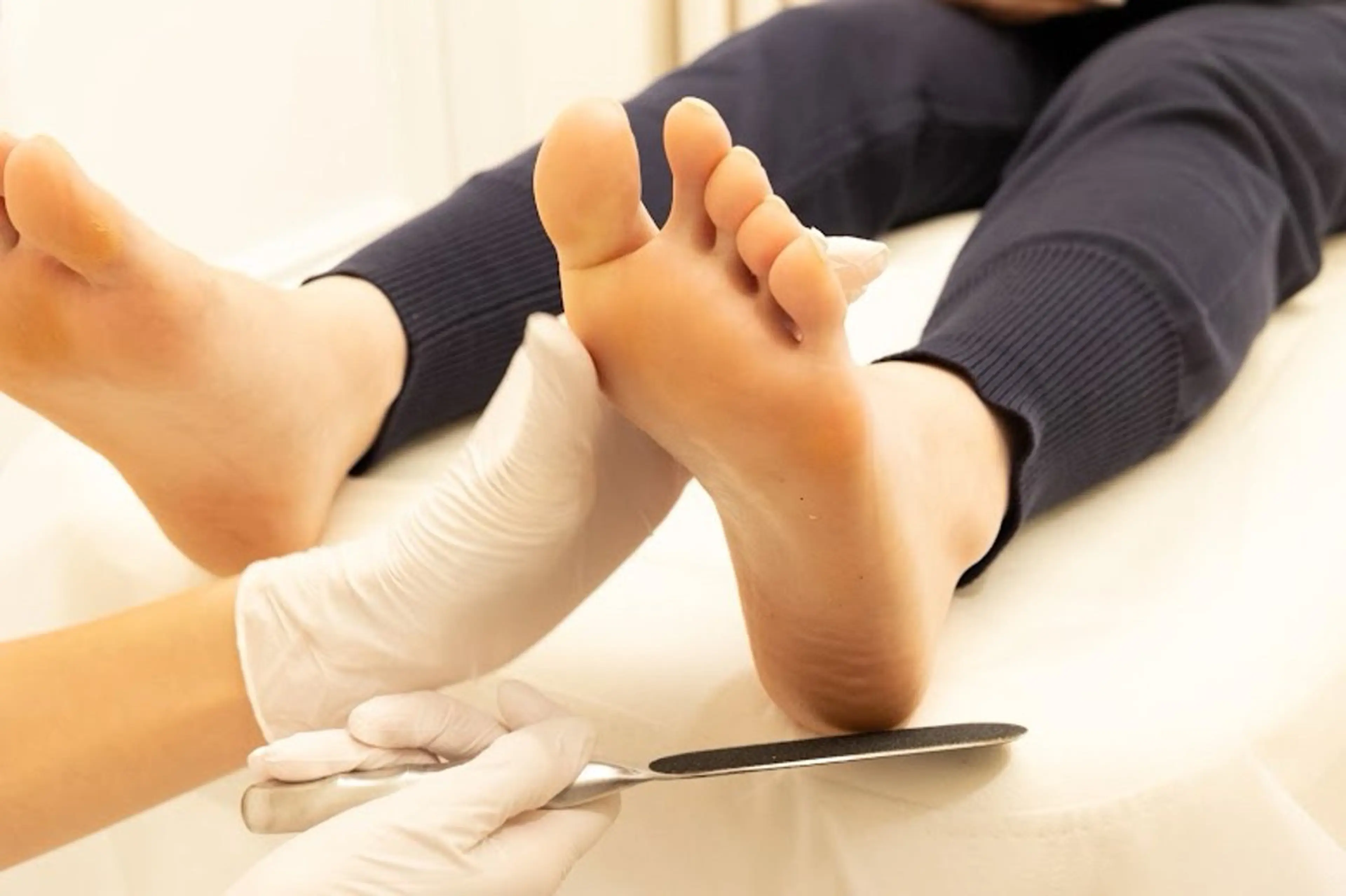 【足裏ケア】タコ、魚の目、かかとガサガサ(40分)の写真