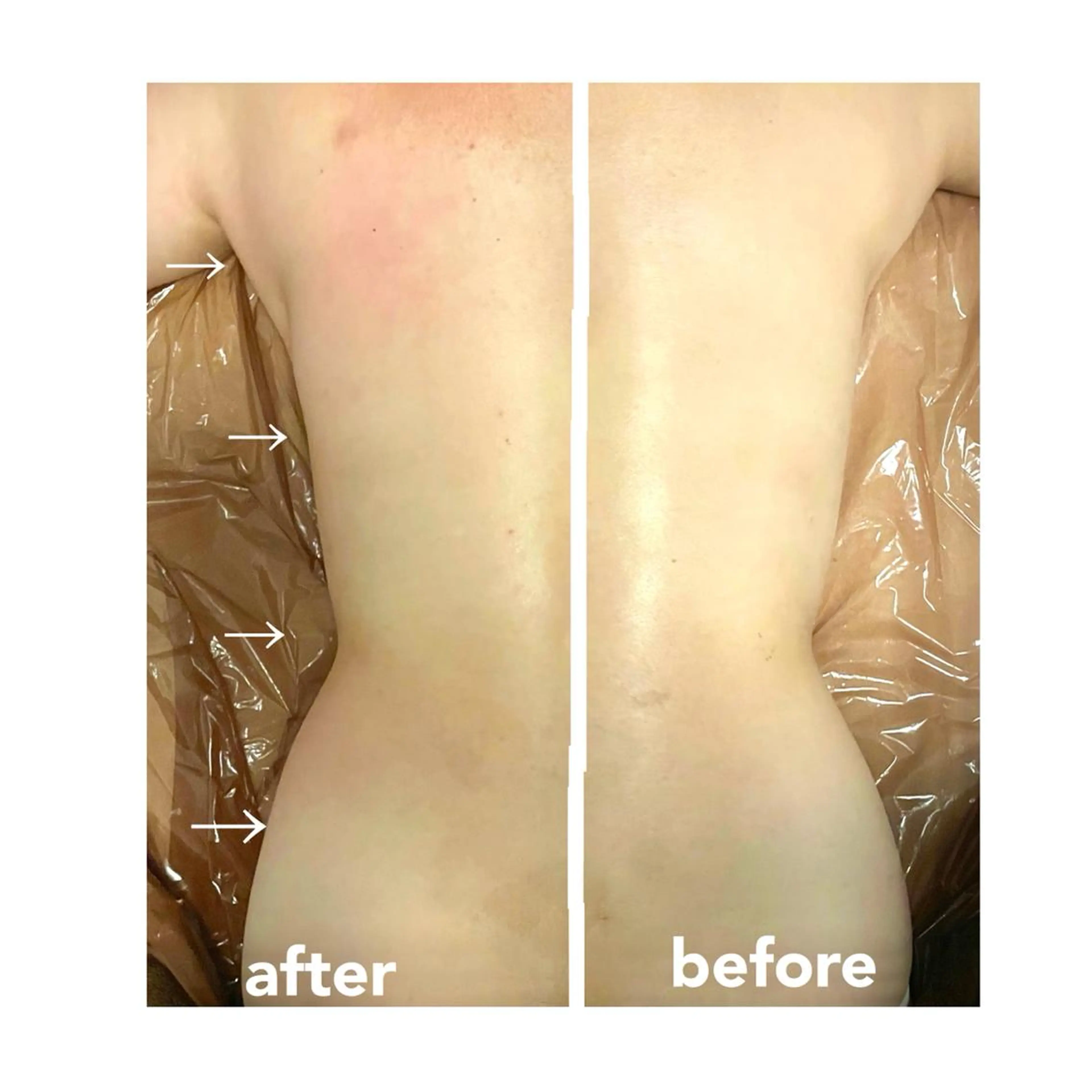 アロマ•ピーリング SalonYokoのその他イメージ