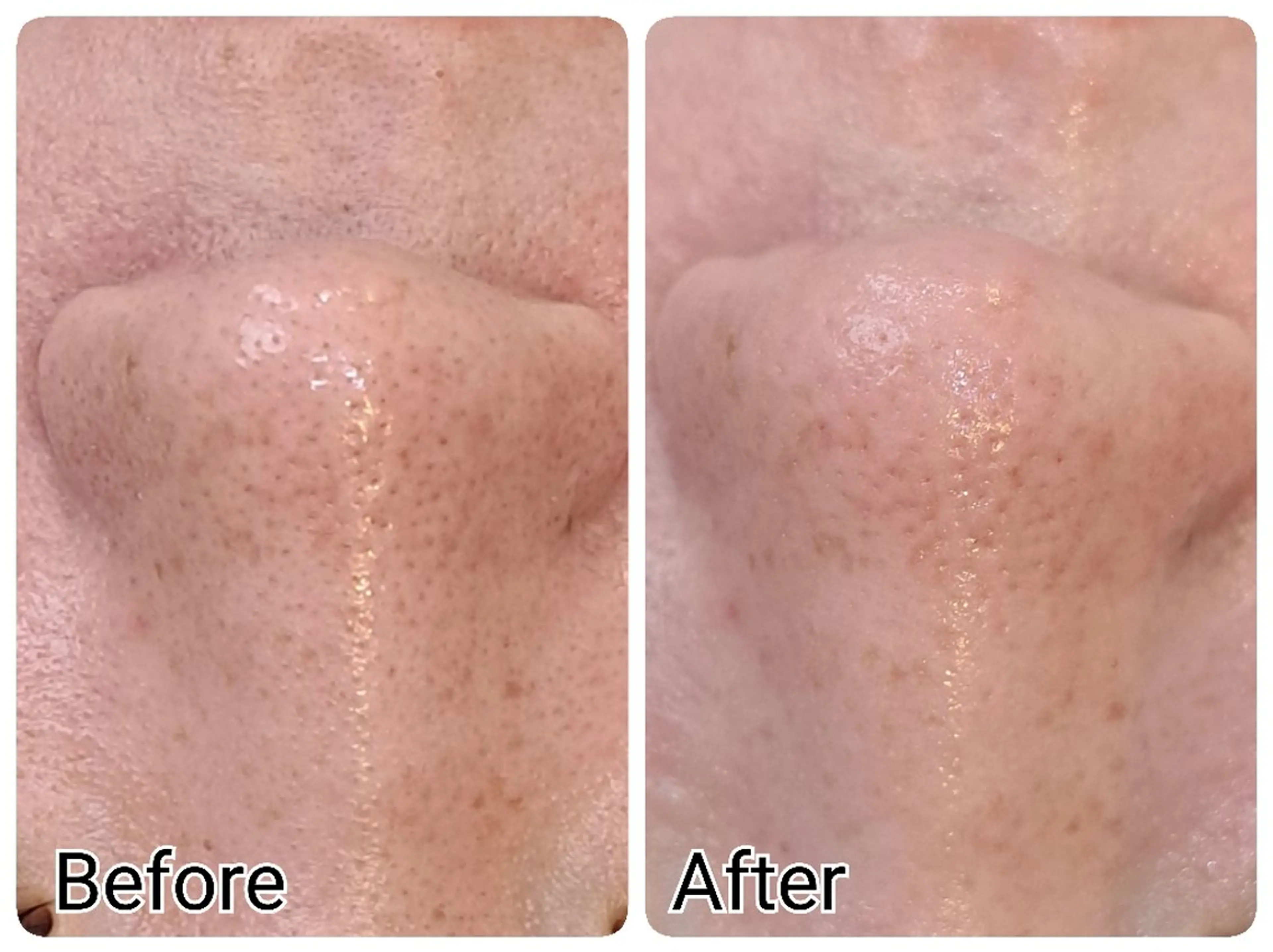 Hisui 種村のエステ・リラクイメージ