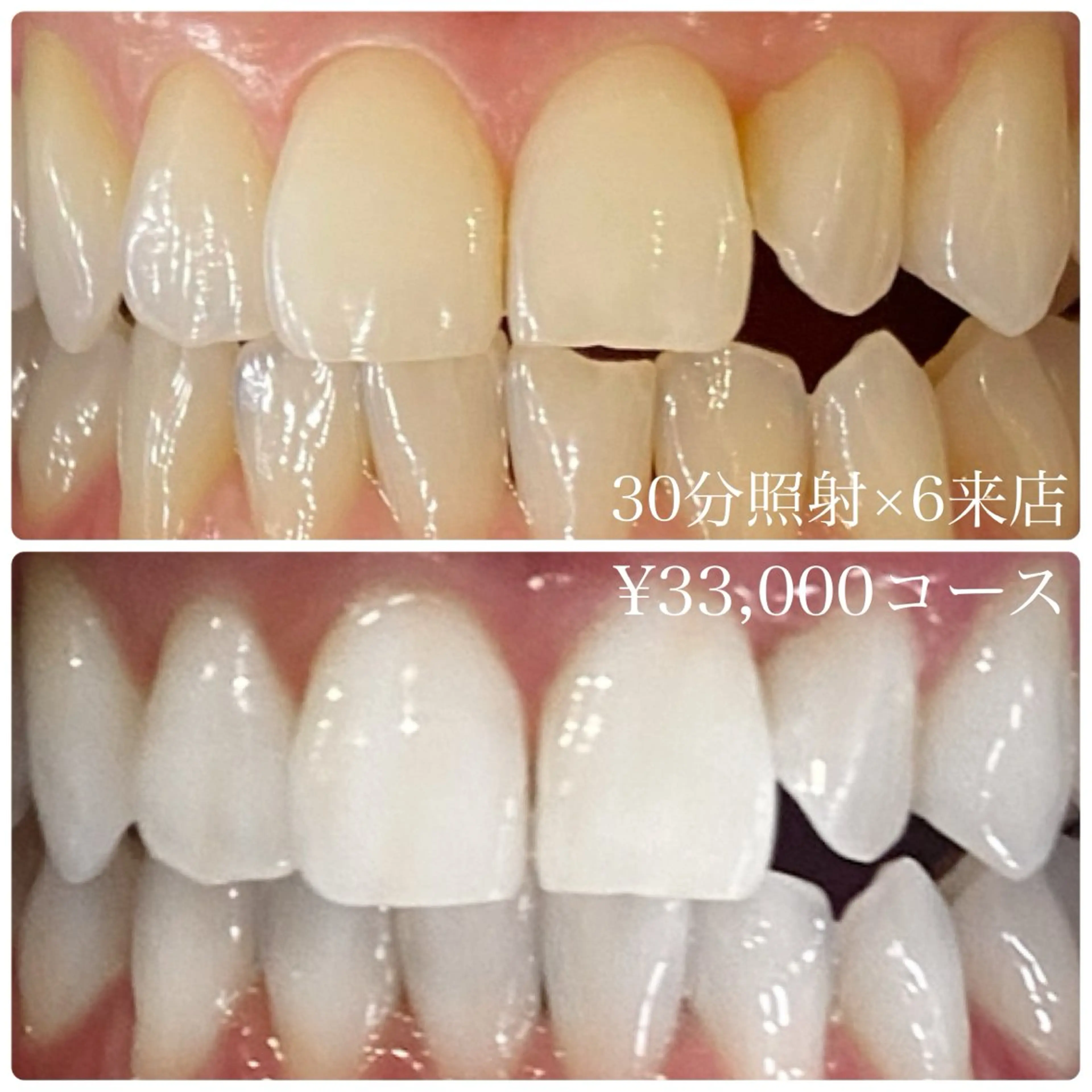 メンズ その他 ホワイトニングルーム　川崎店所属・ホワイトニング ルーム　川崎店のその他イメージ